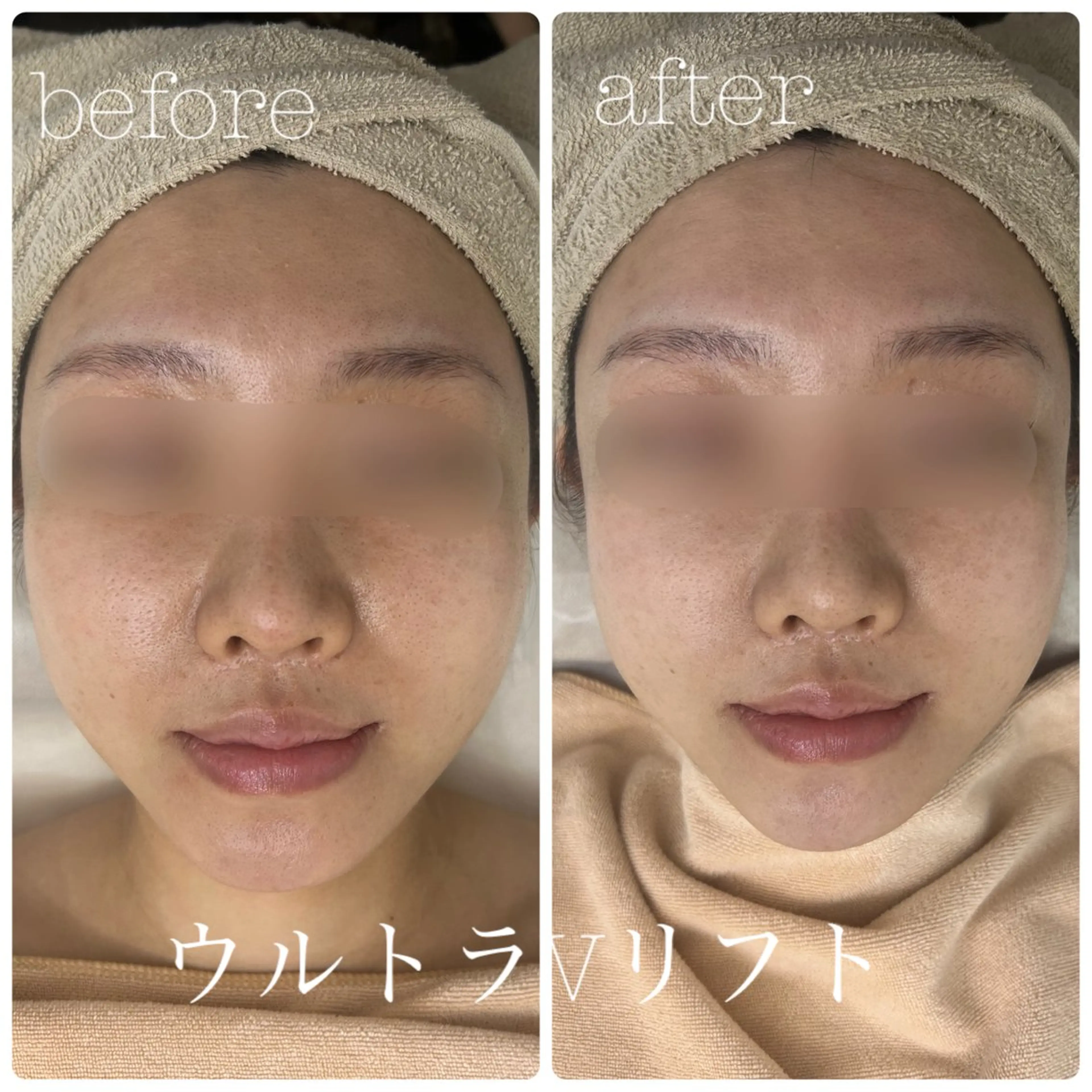 エステ フェイシャルサロン CHIARA 荒田のエステ・リラクイメージ