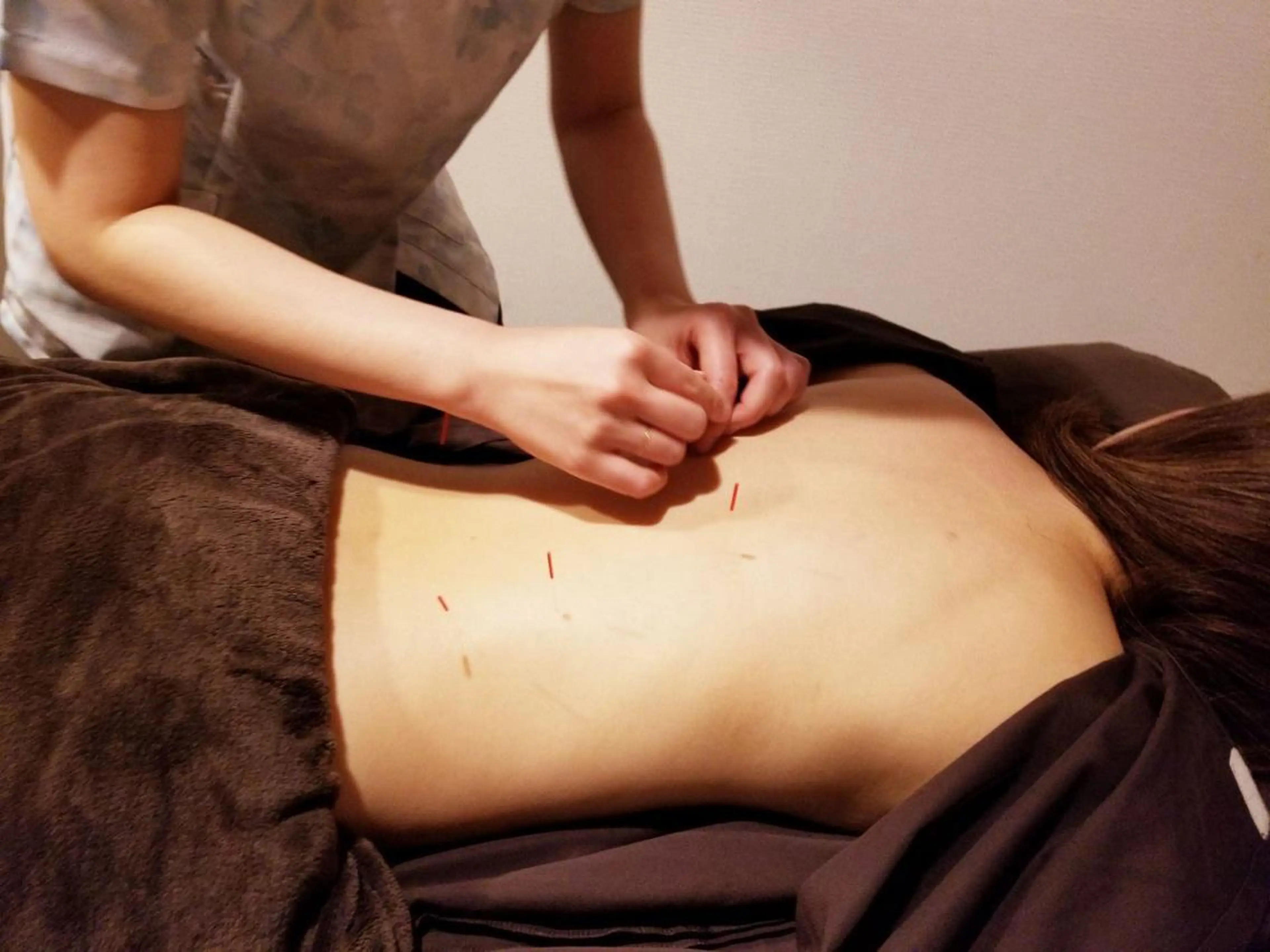 【乱れやすいこの季節限定】自律神経鍼灸（約60分）の写真