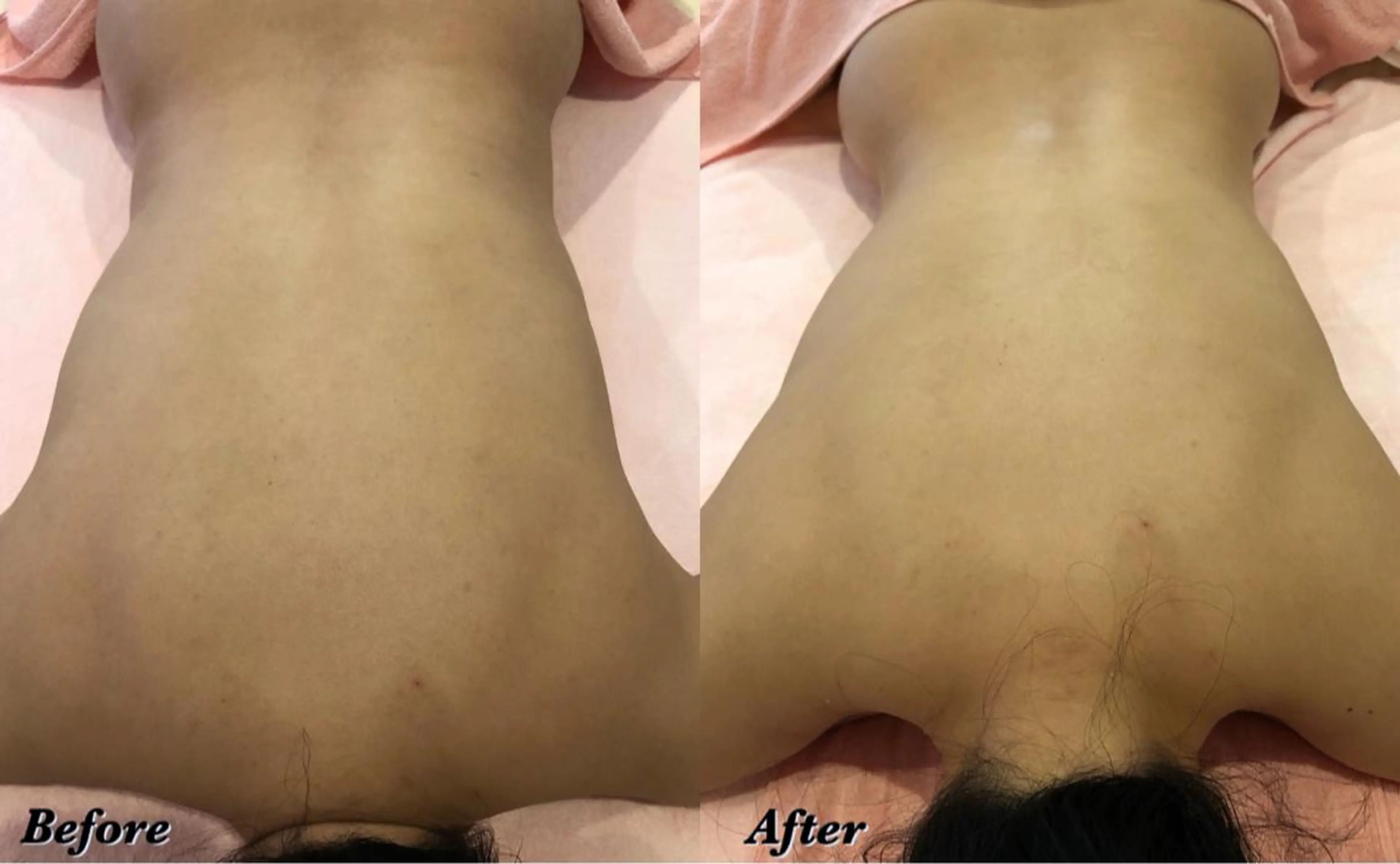 エステサロン　Sブランペタル所属・三沢市エステサロン Sブランペタルのエステ・リラクイメージ