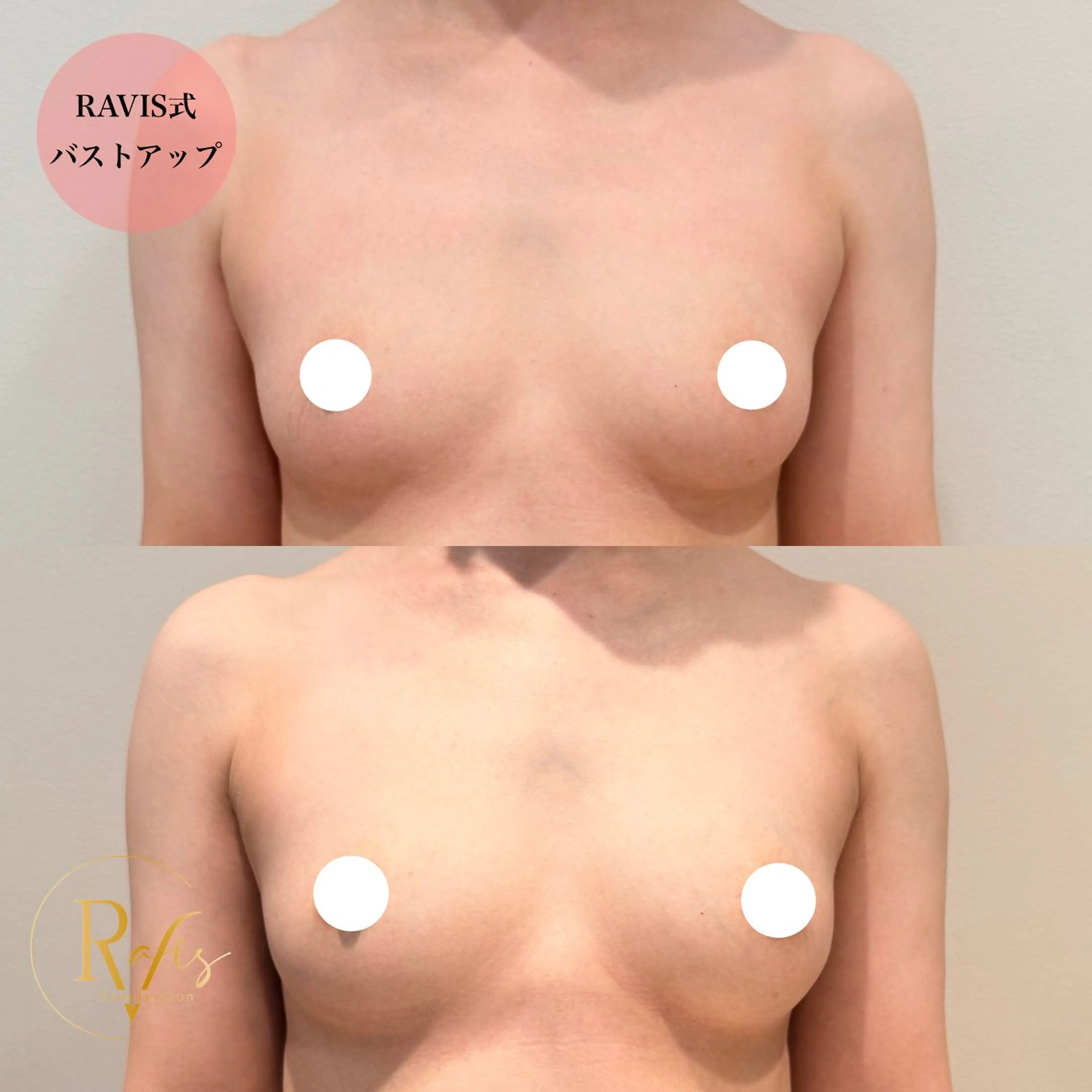 エステ beautysalon RAVIS所属・東大阪/韓国肌管理/ 痩身バスト専門店のエステ・リラクイメージ