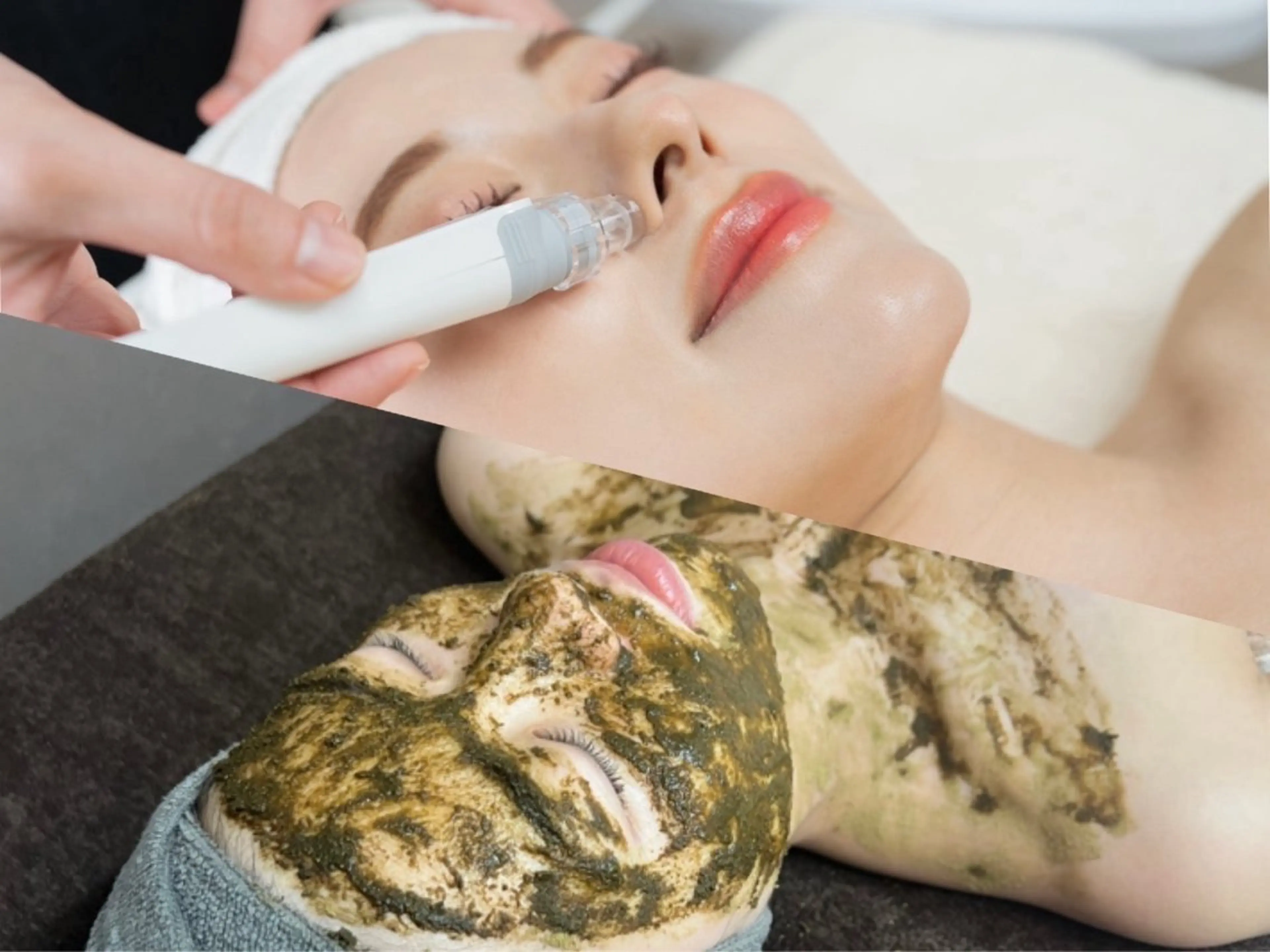 新人割⚠️現金のみ⚠️【モニター様募集/口コミ必須】 全顔ハーブピーリング×毛穴洗浄の写真