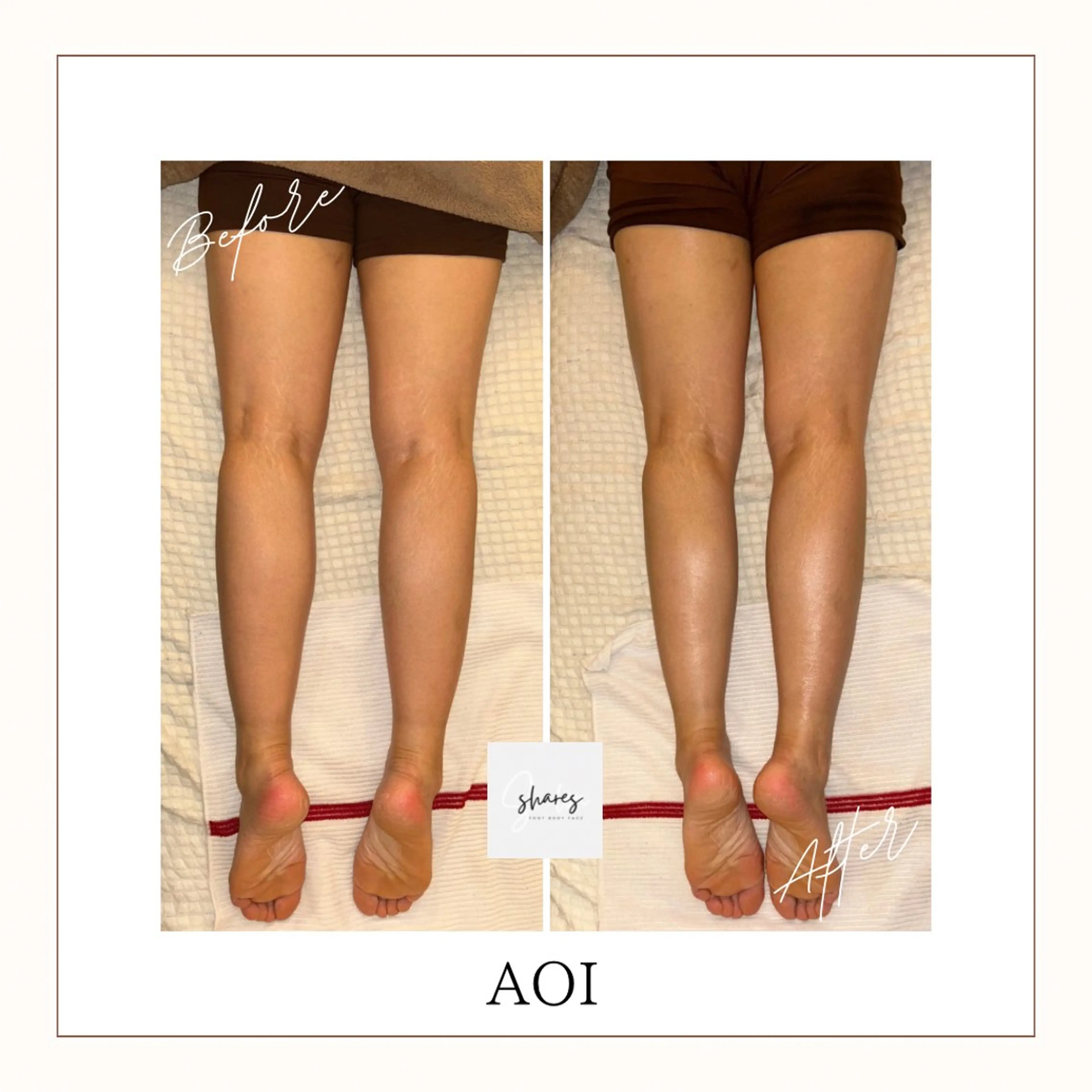 salon shares 辻堂店所属・SHARES AOIのエステ・リラクイメージ