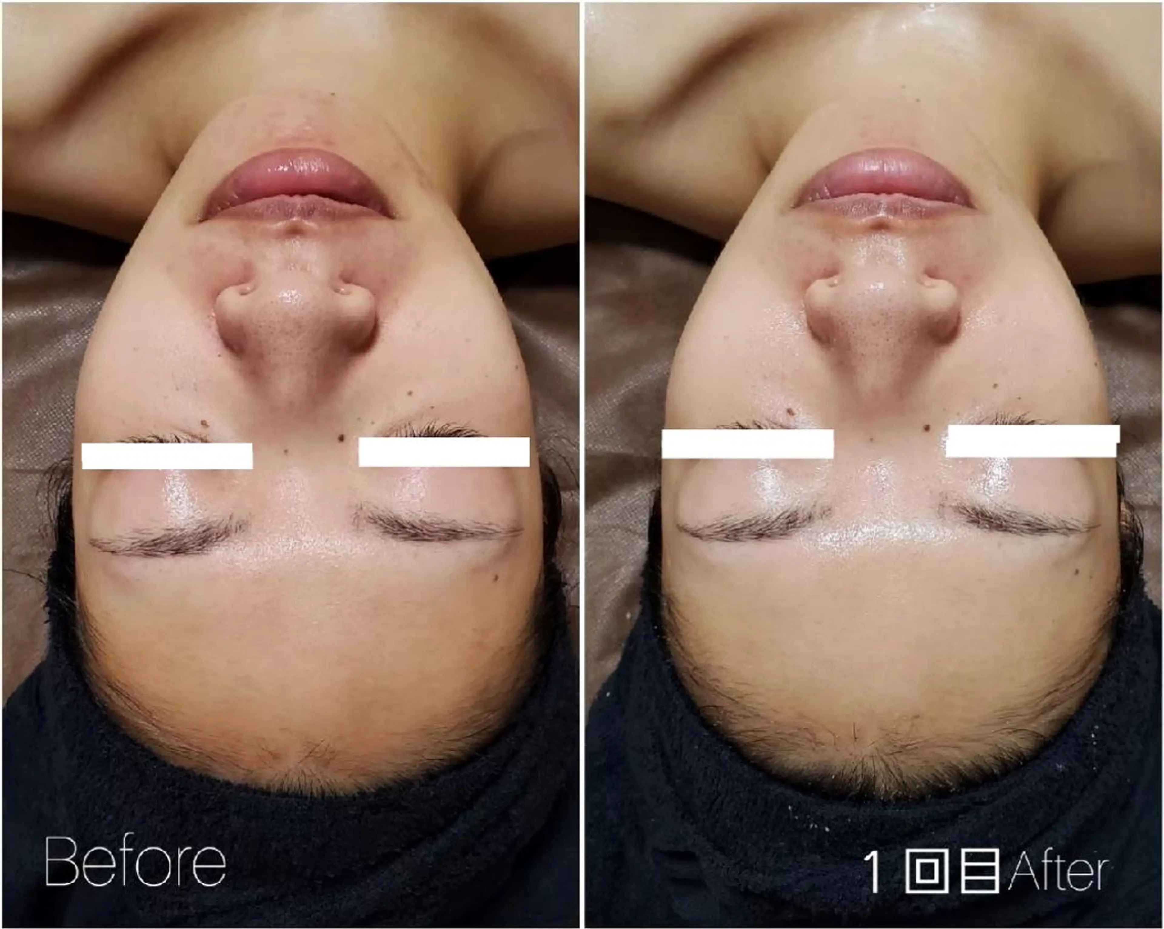 エステ ALOHA RETREATのエステ・リラクイメージ