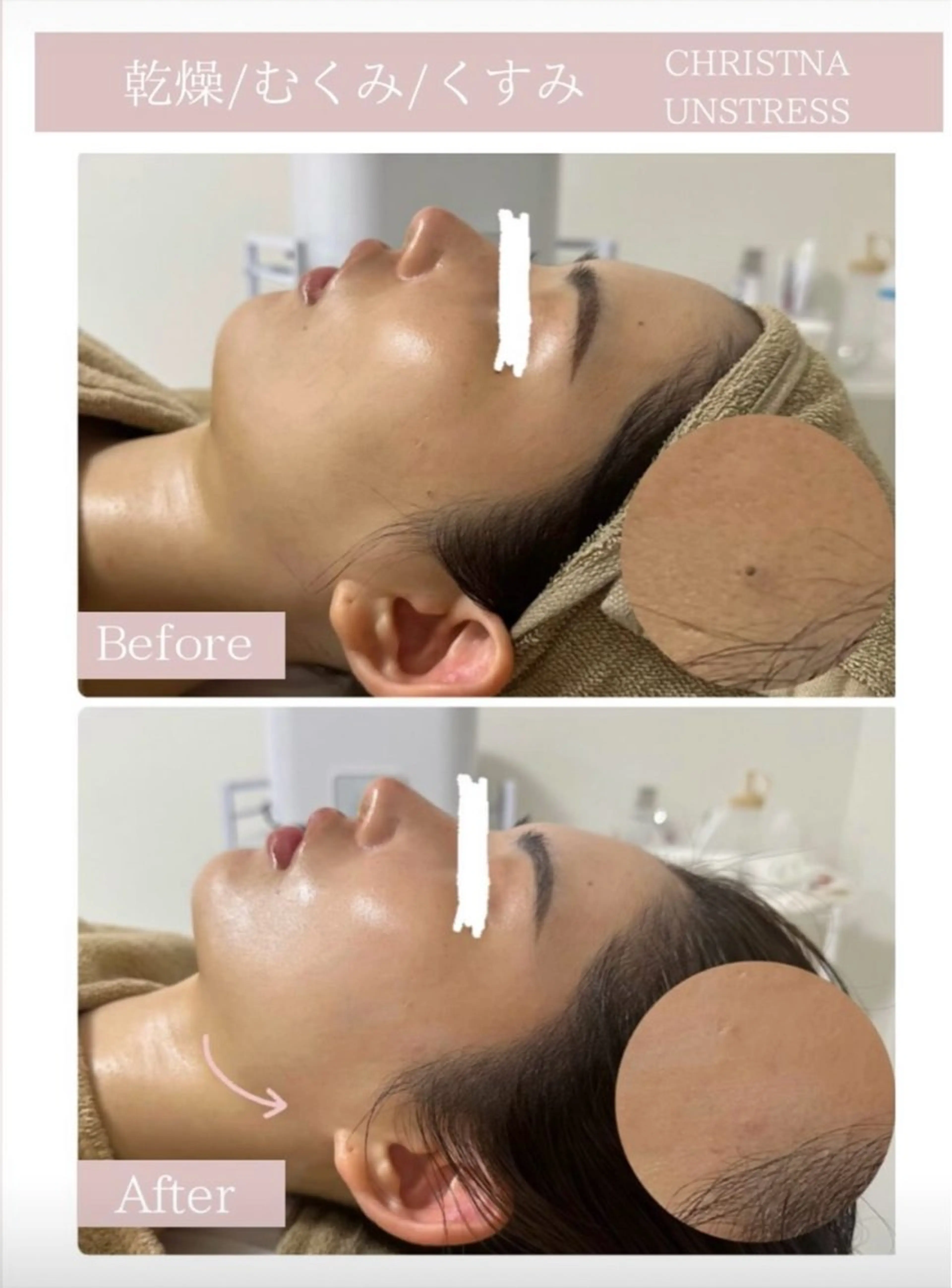 エステ Total beauty salon Remy所属・Remy♡ 石井澪菜のエステ・リラクイメージ