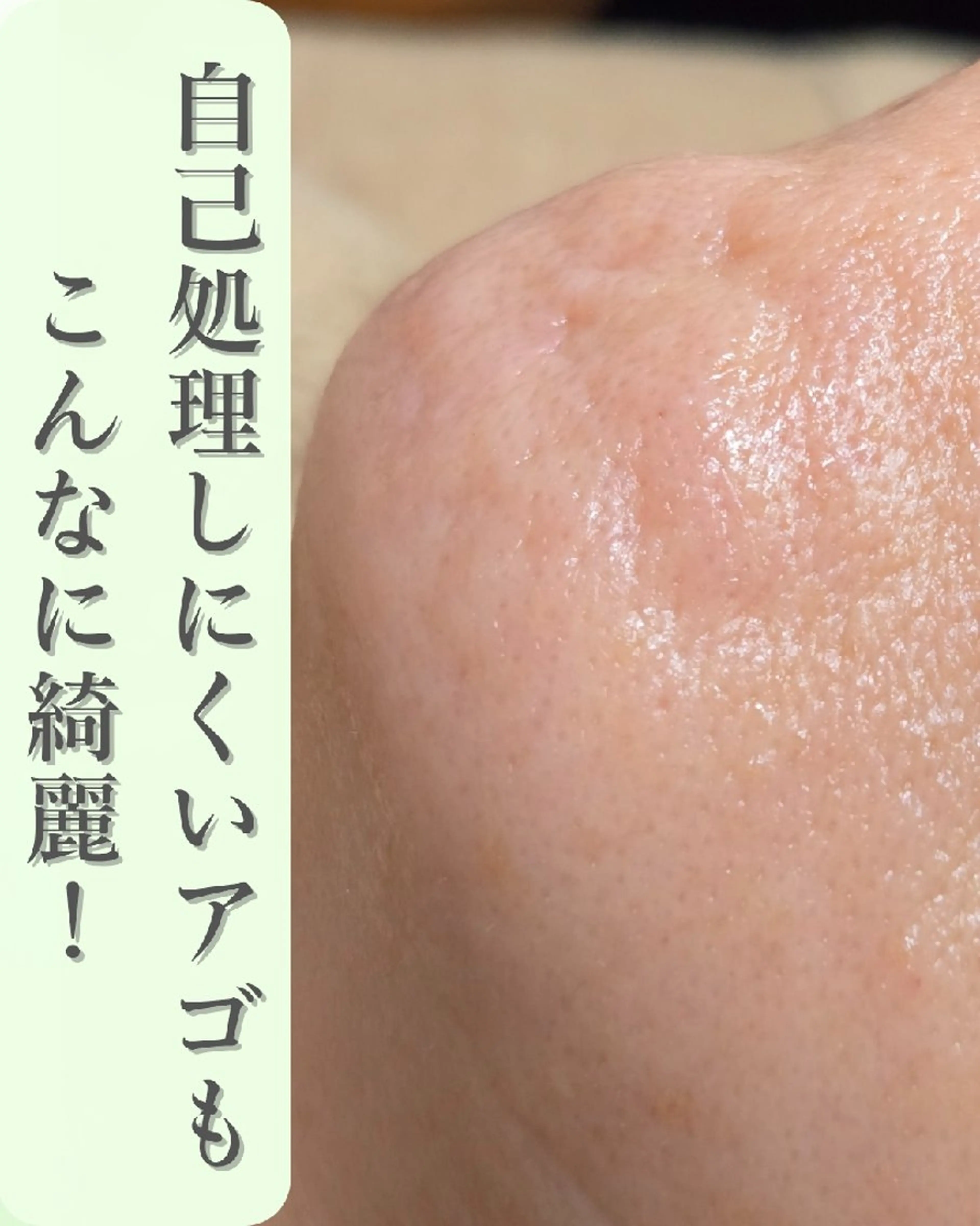 フェイシャルワックス GLOW所属・渡邊 真依のエステ・リラクイメージ