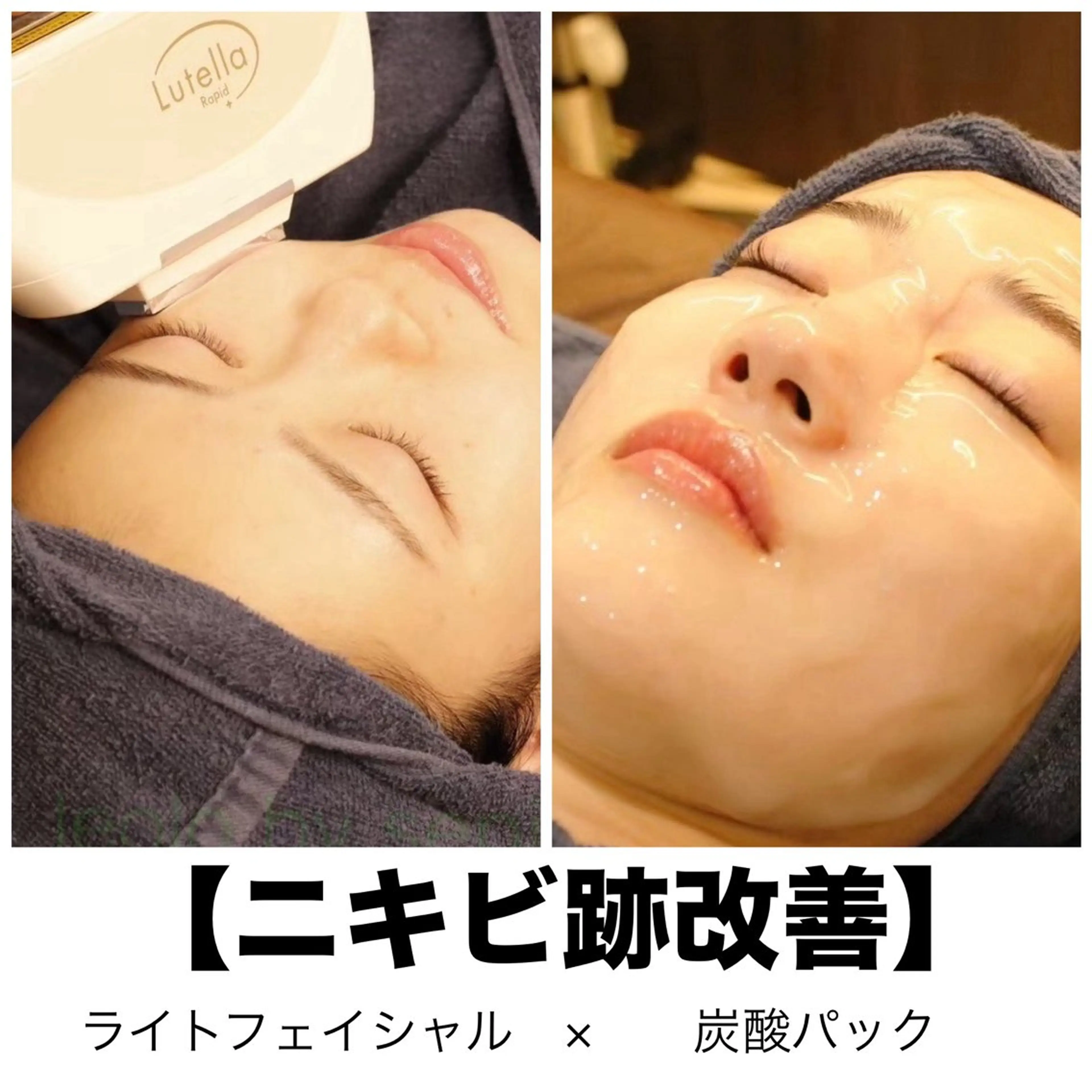 leolo武蔵浦和 肌質改善＆脱毛のエステ・リラクイメージ