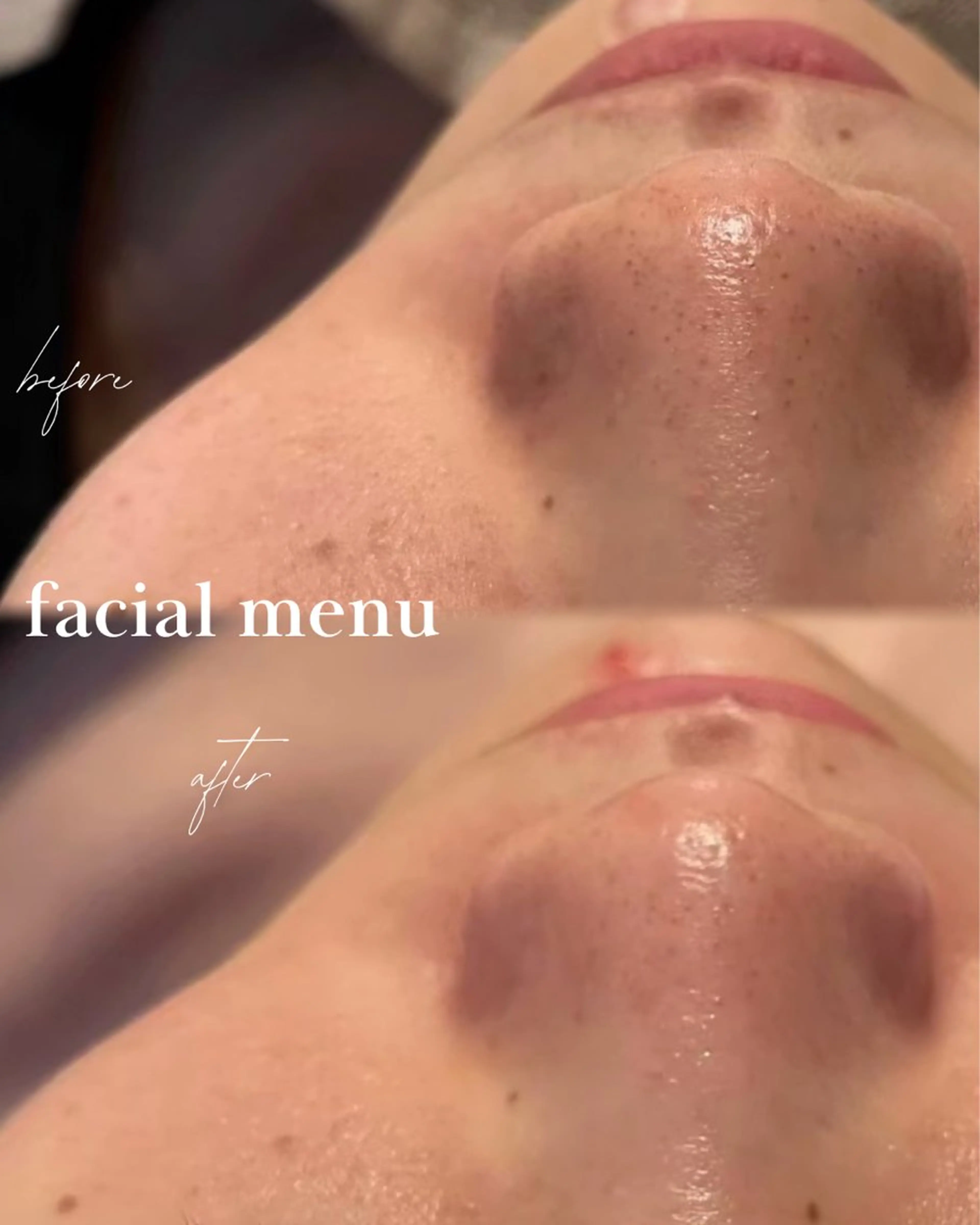 Linoa skin salon所属・Linoa 大名のエステ・リラクイメージ