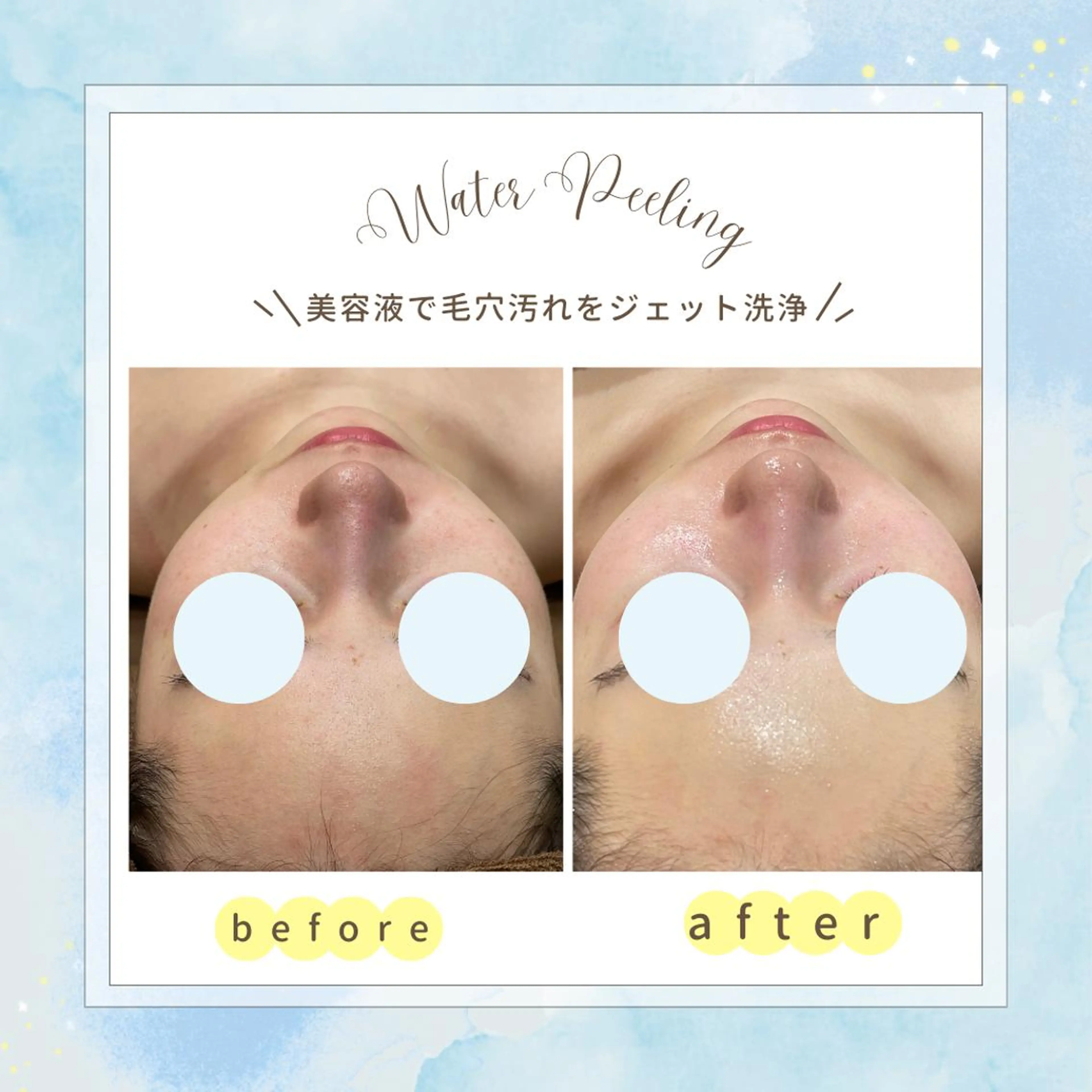 エステ 🌿小顔・痩身・脱毛 レイビス川崎店🌿のエステ・リラクイメージ