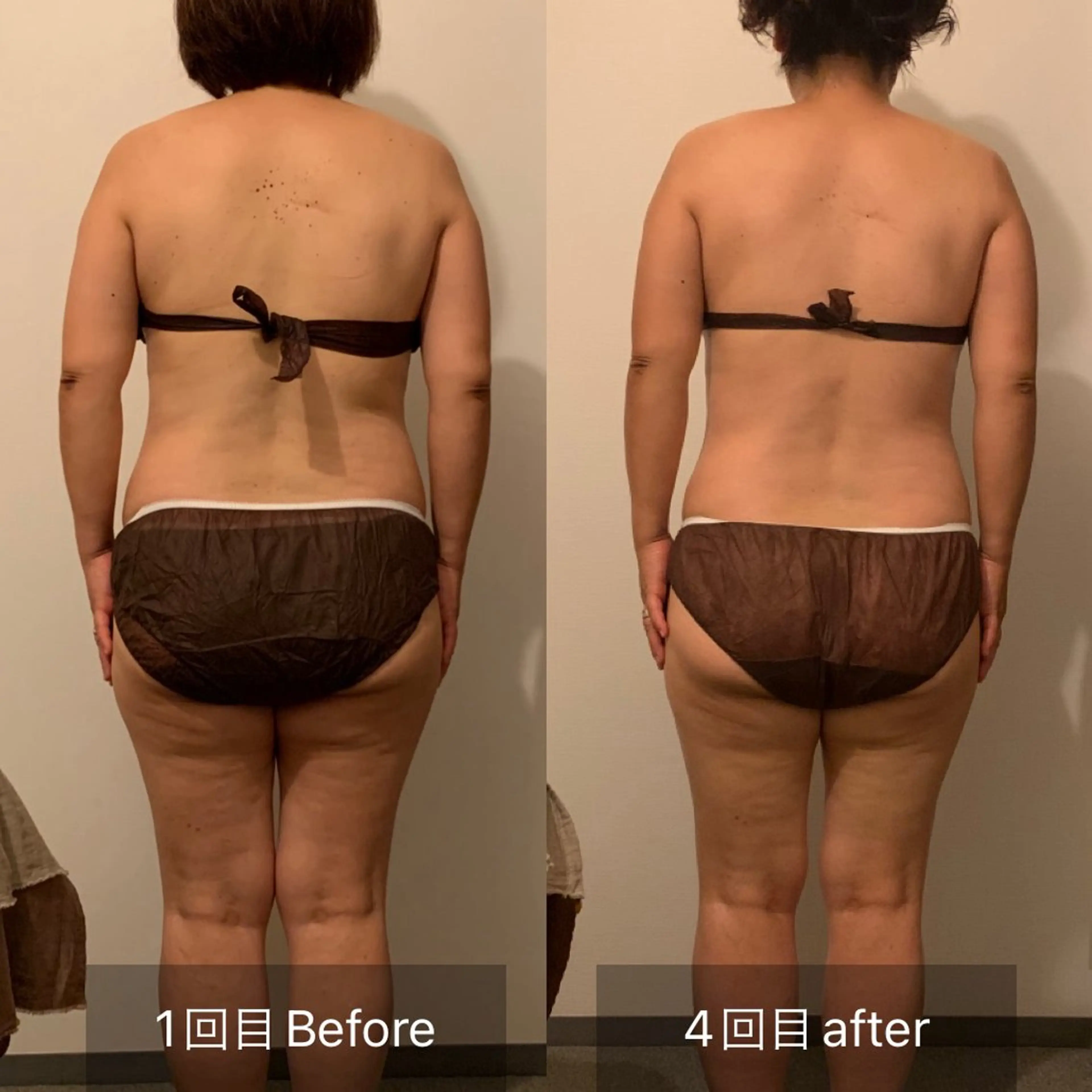 美姿勢調整の写真