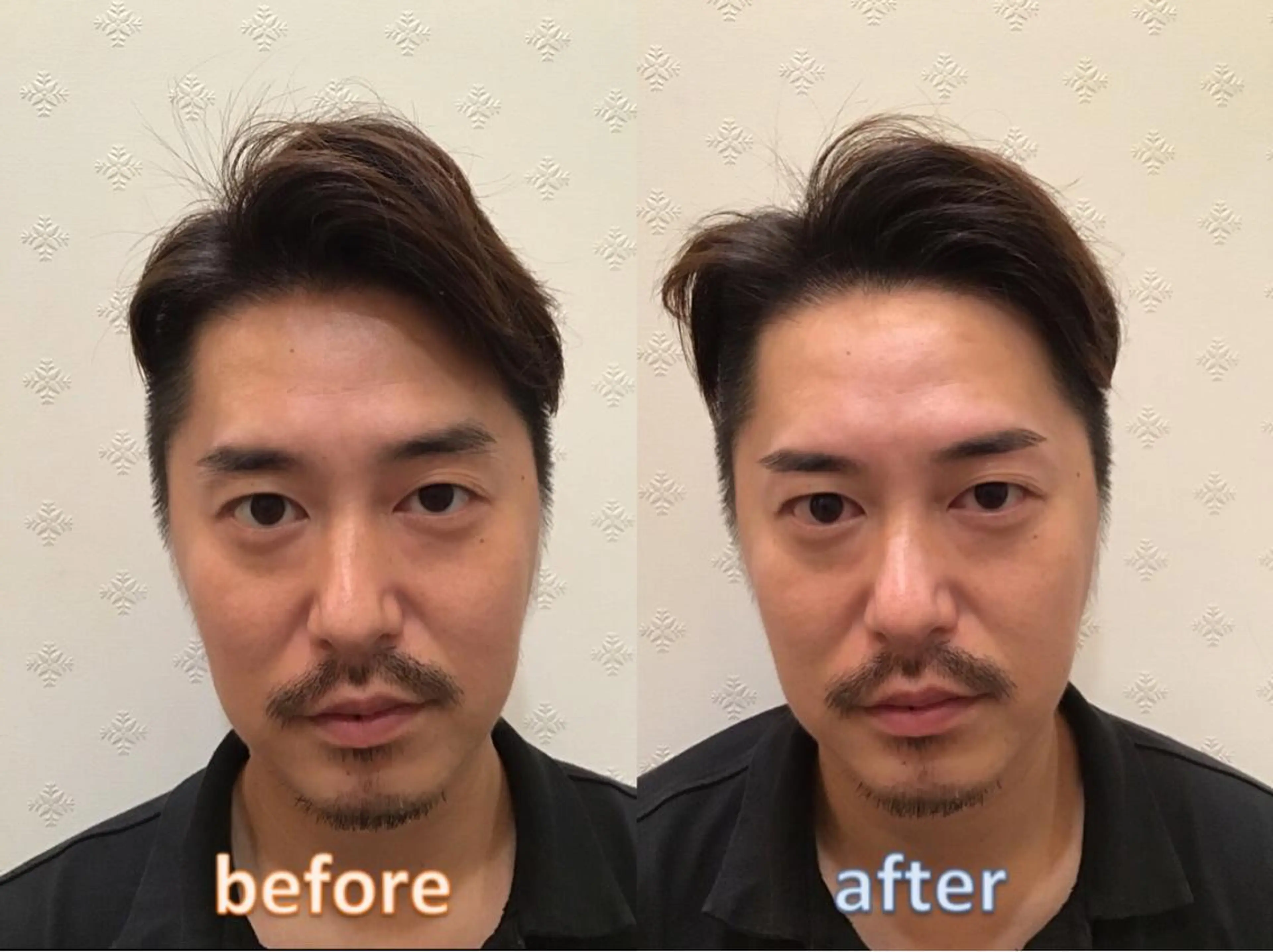 佐藤 悠里のネイルデザイン