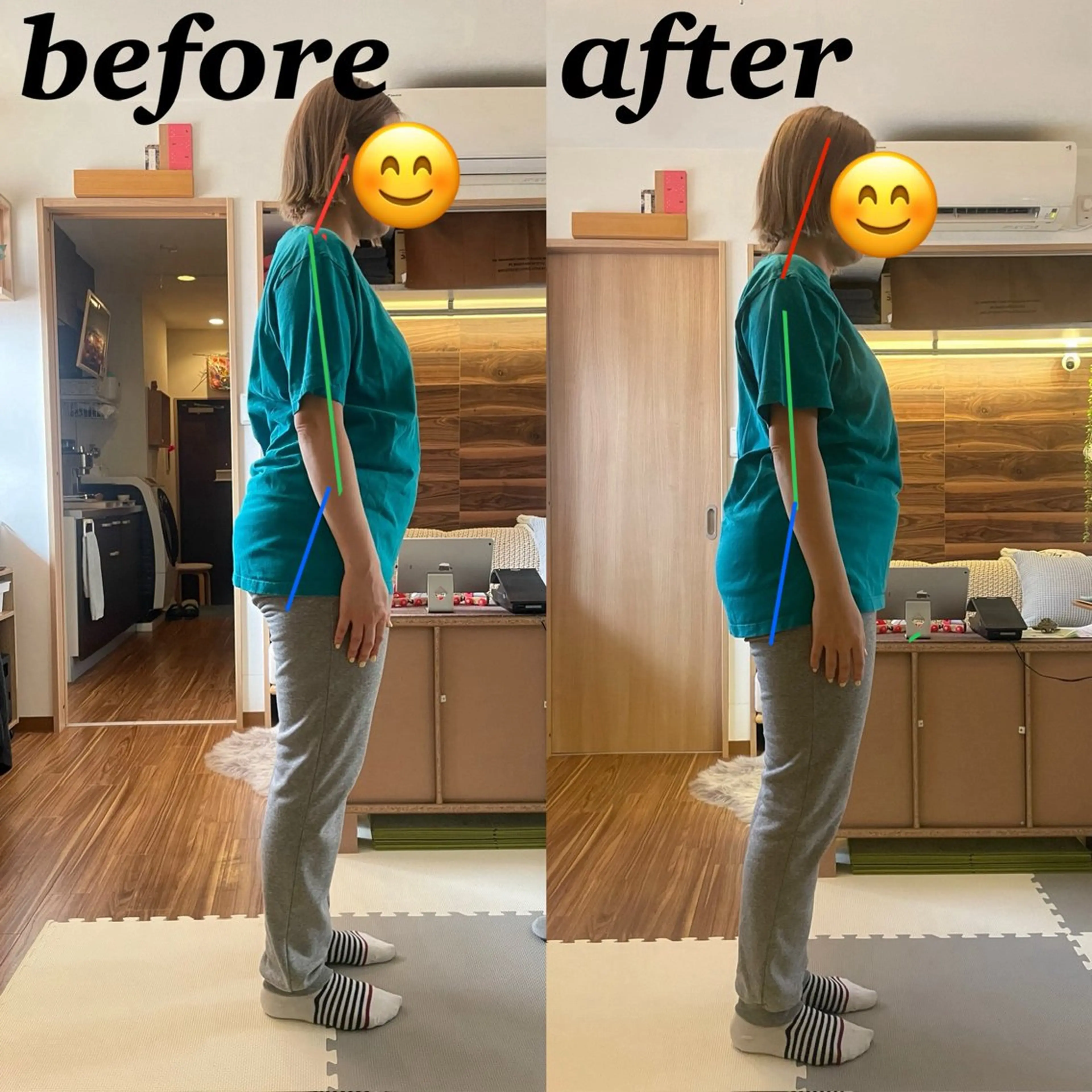 【反り腰改善】腰の痛み、姿勢が気になる方はこれ！60分5800円の写真