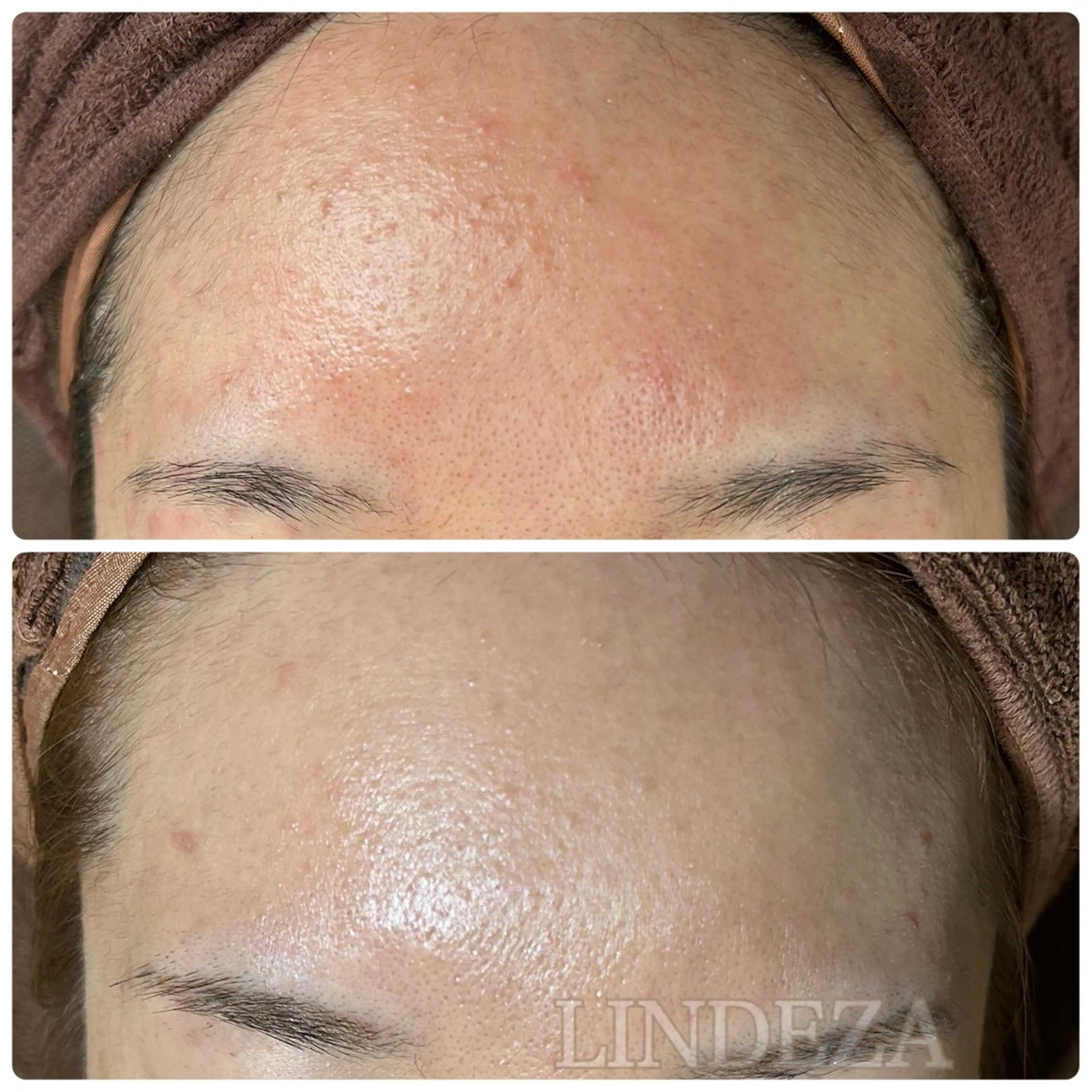 private salon 𝐋𝐈𝐍𝐃𝐄𝐙𝐀所属・LINDEZA Ayaのエステ・リラクイメージ