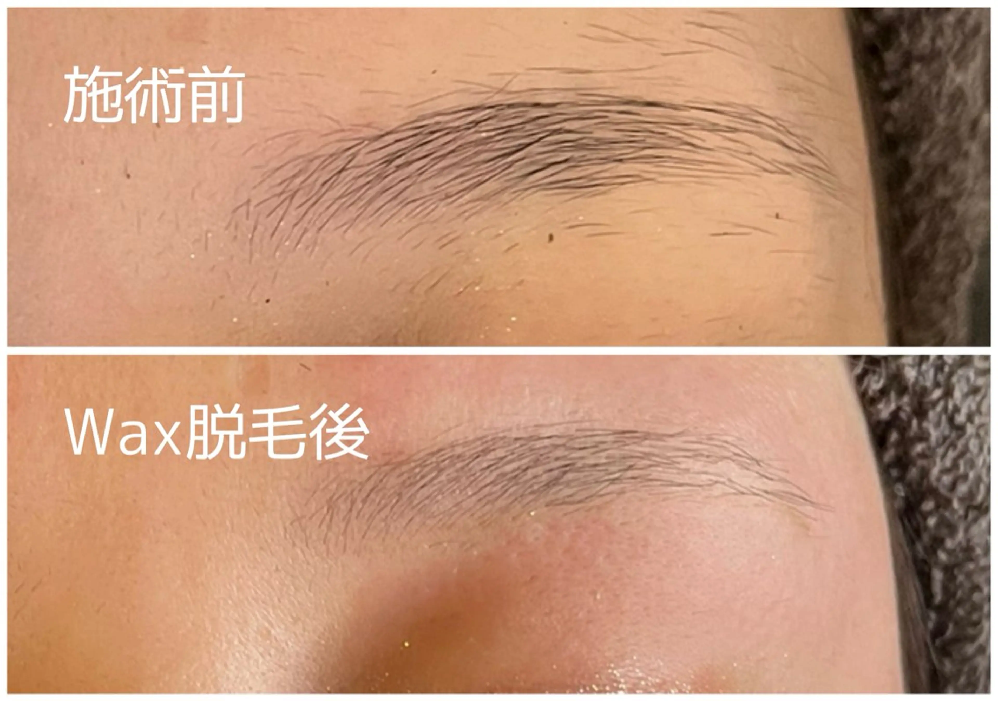 【初回】お手軽眉毛Wax脱毛の写真