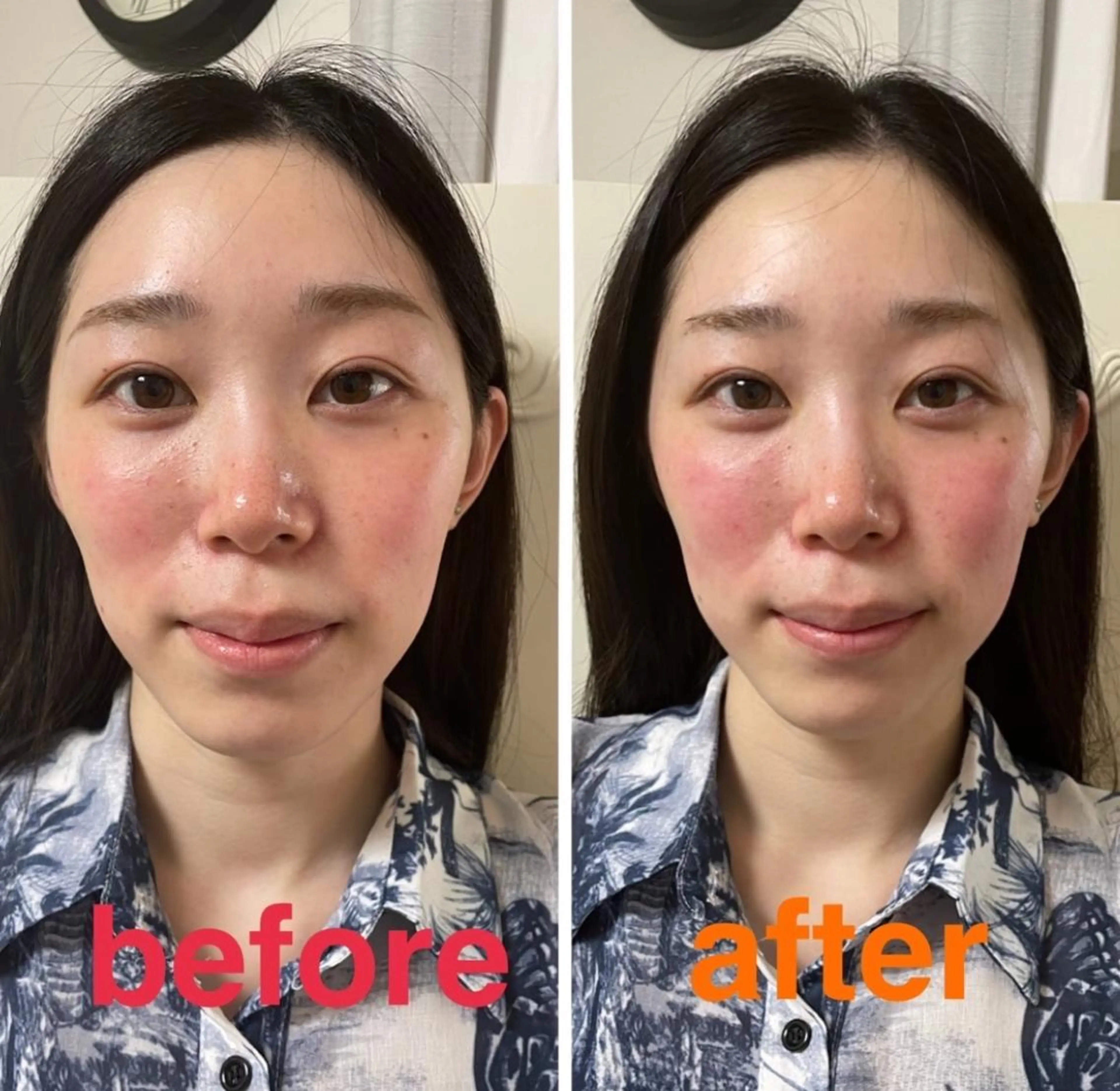 エステ リラク 美容鍼灸サロン mahoroba院長のエステ・リラクイメージ