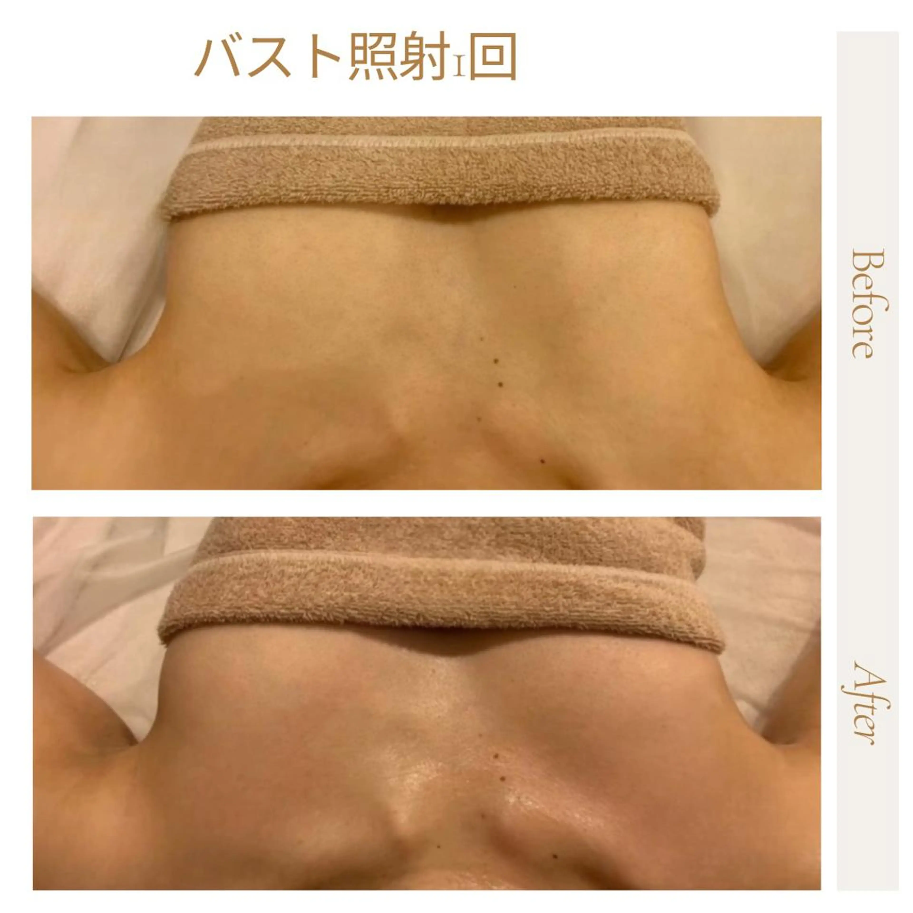 【バストケア】サイズアップ&ハリUP＊バストアップケア¥8000の写真