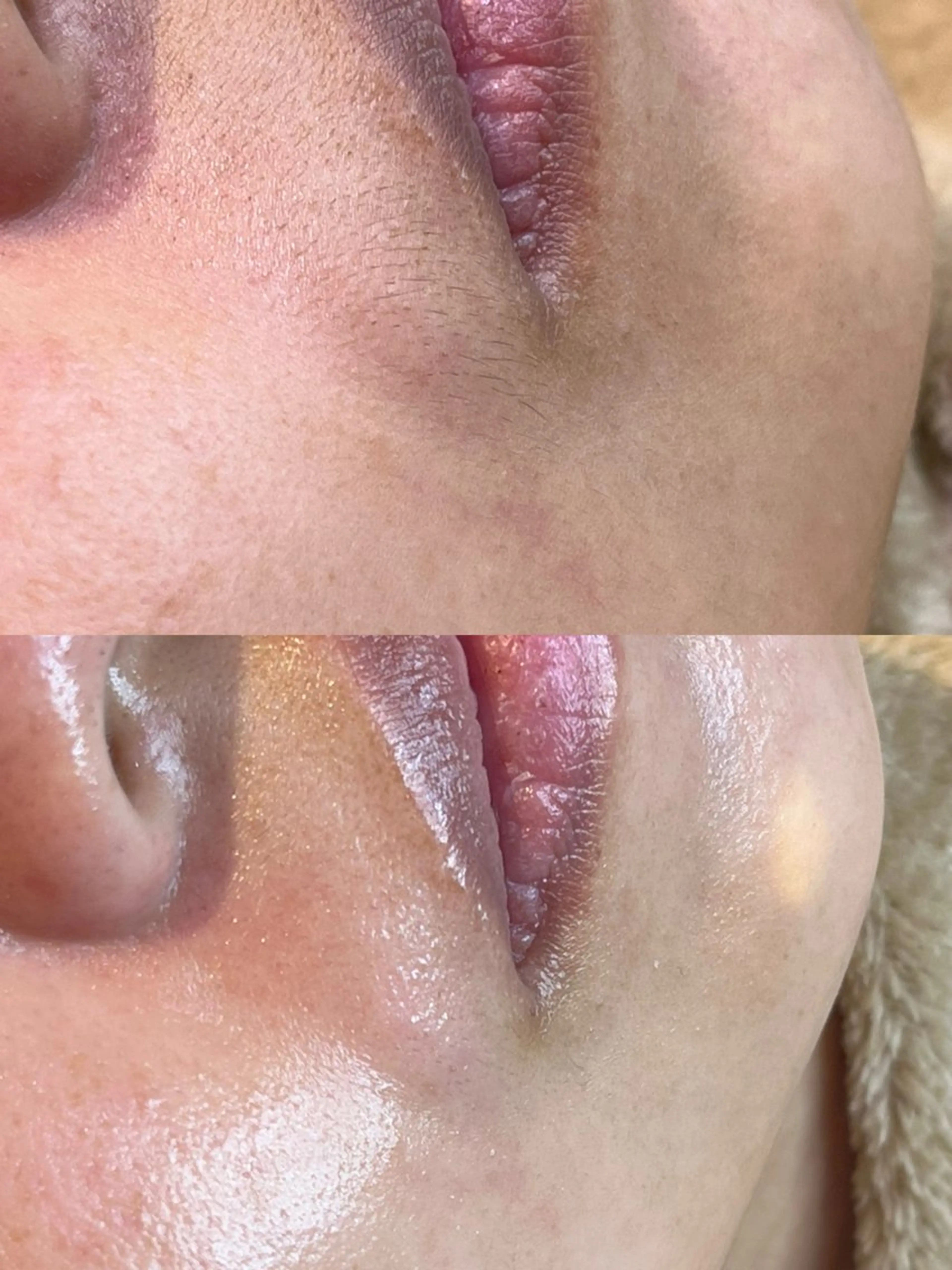 口周り美肌WAX✨（うぶ毛・角質オフで化粧ノリUP）の写真