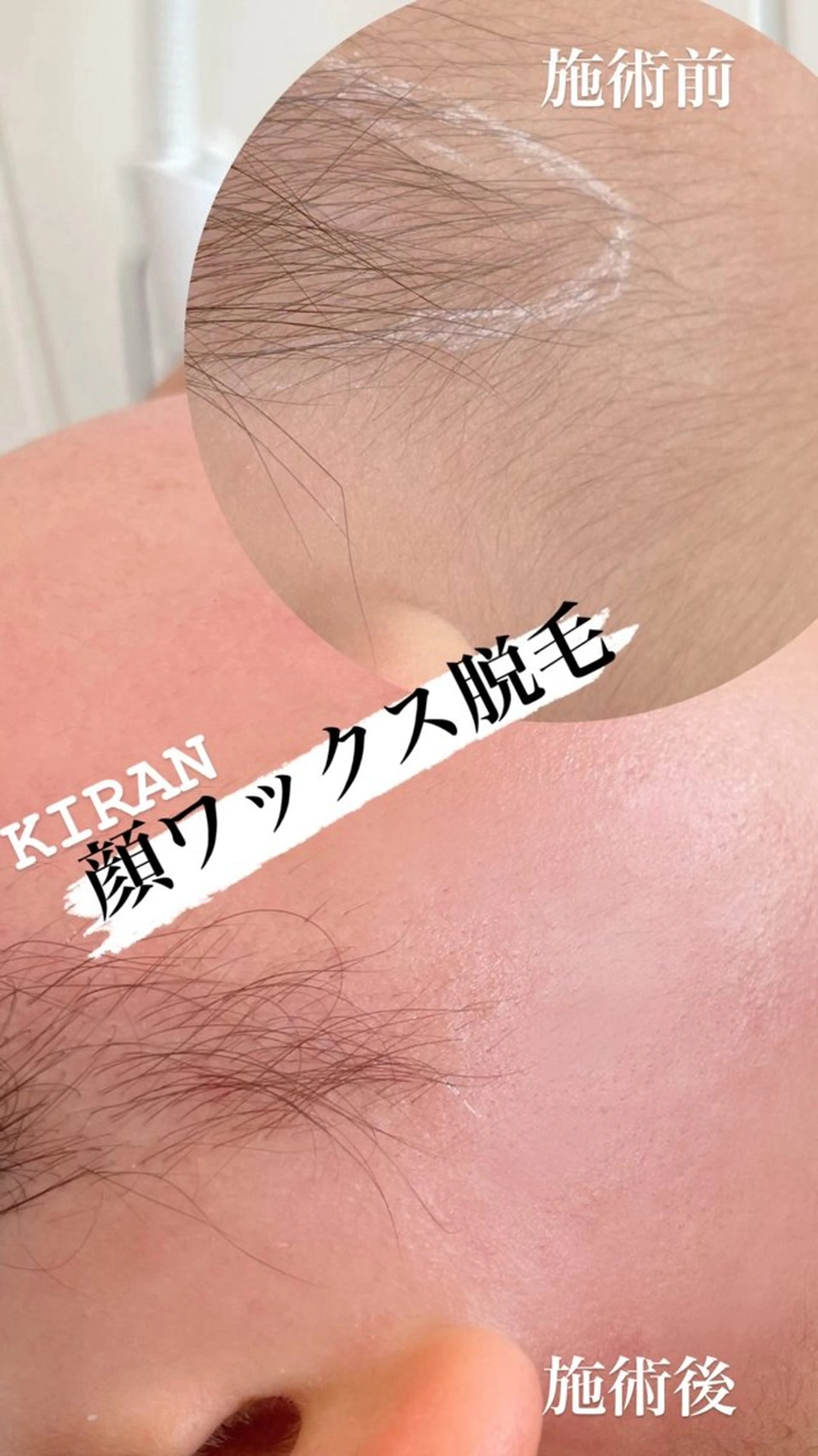 KIRAN 山﨑のエステ・リラクイメージ