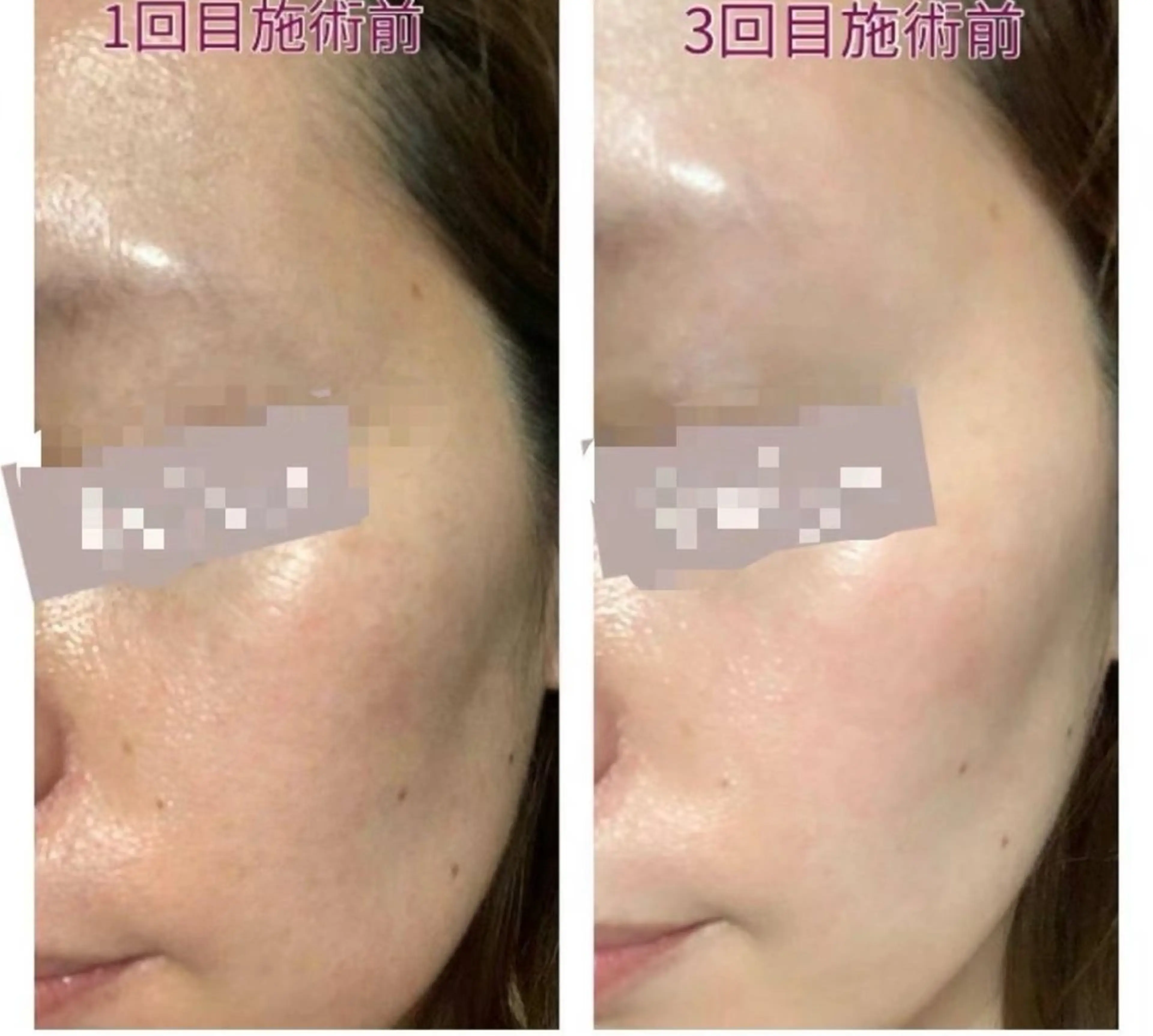 Queen Salonのエステ・リラクイメージ