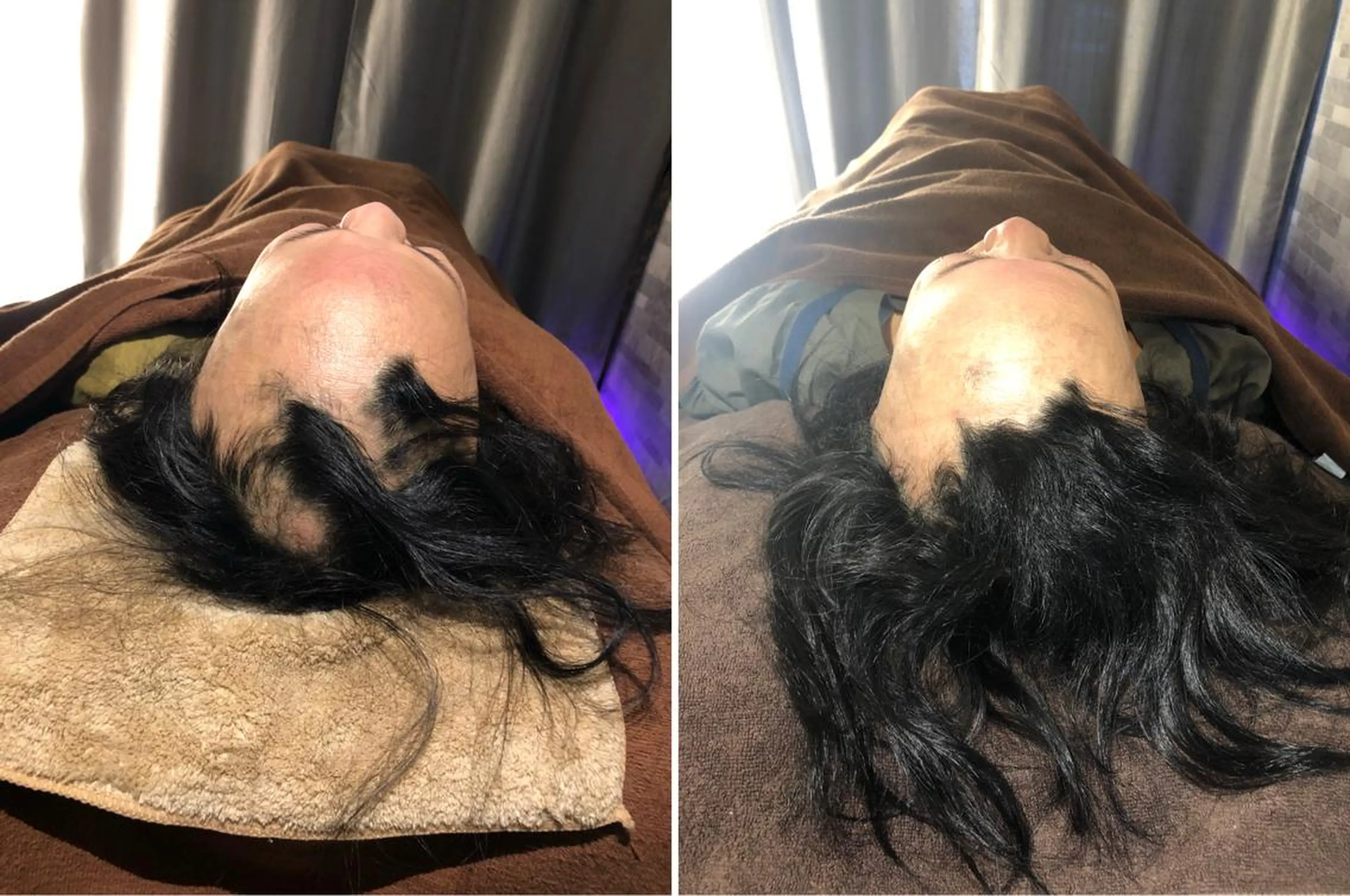 【今月限定】人気No.❷育毛を真剣にお悩みの方。ヘアケアで髪質がパサパサしてまとまらない方。90分💖の写真