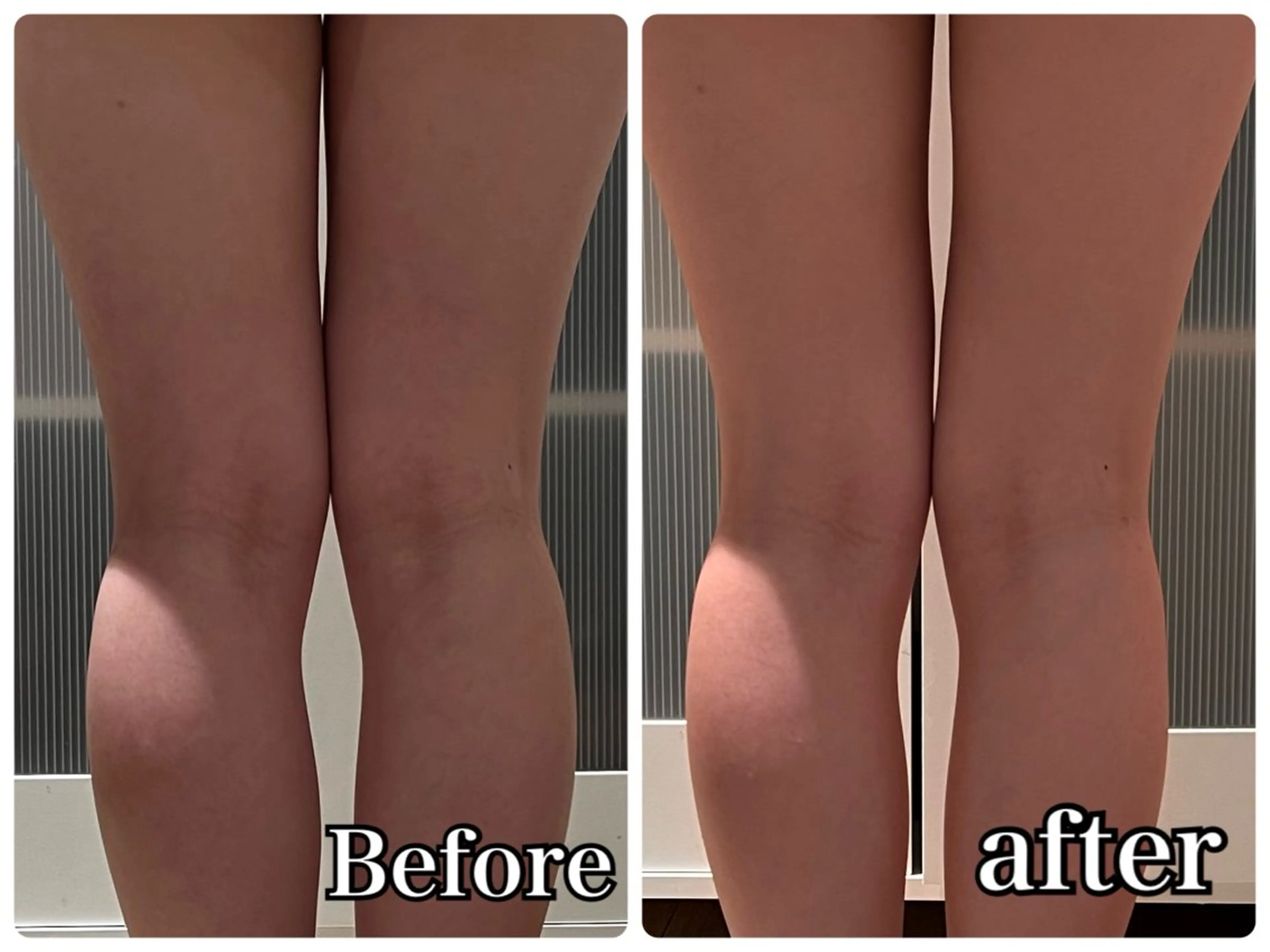 上半身or下半身痩身ボディメニューの写真