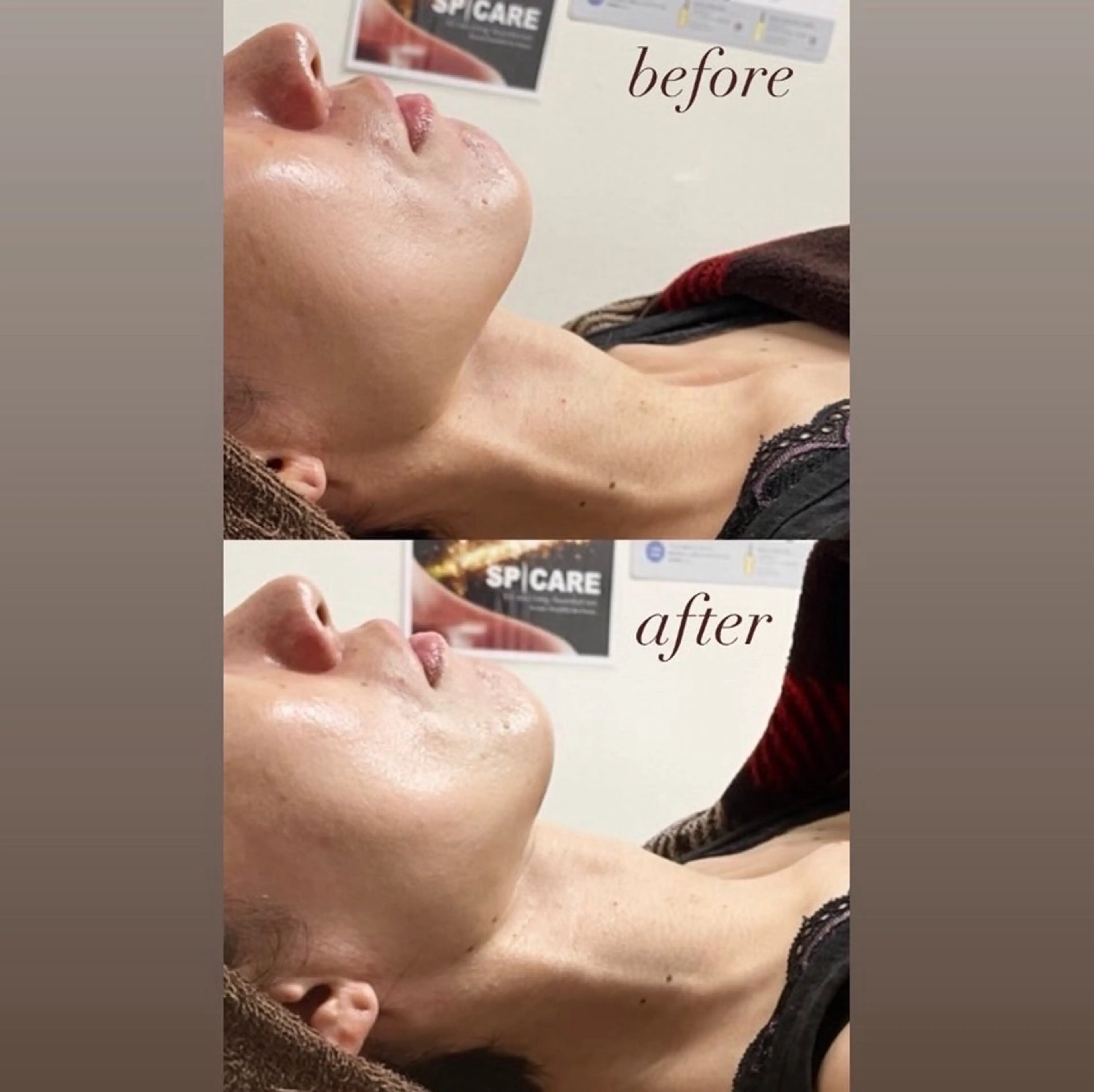 エステ smile nail スマイルネイルのその他イメージ