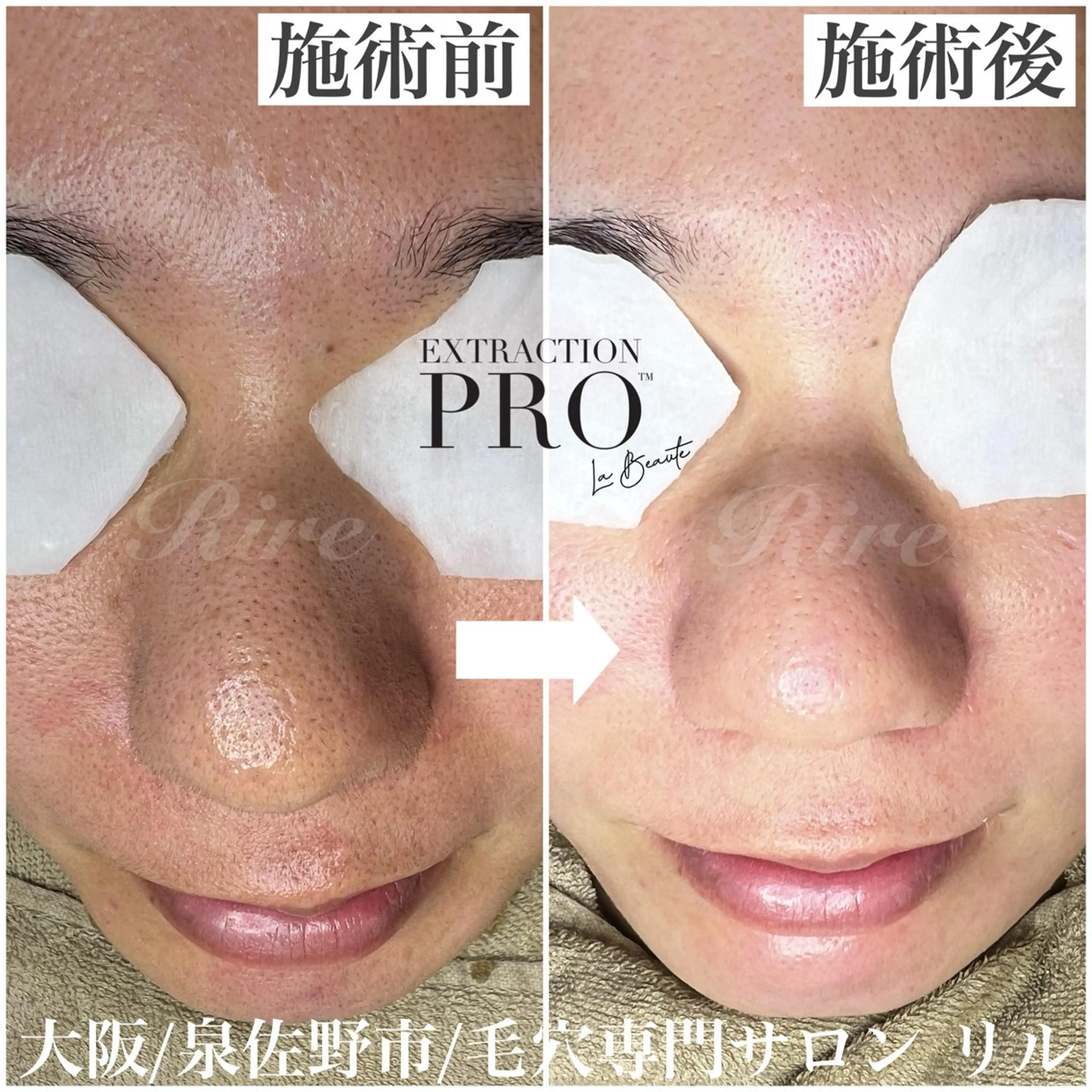 エステ 隅田 都布子のマツエク・マツパデザイン