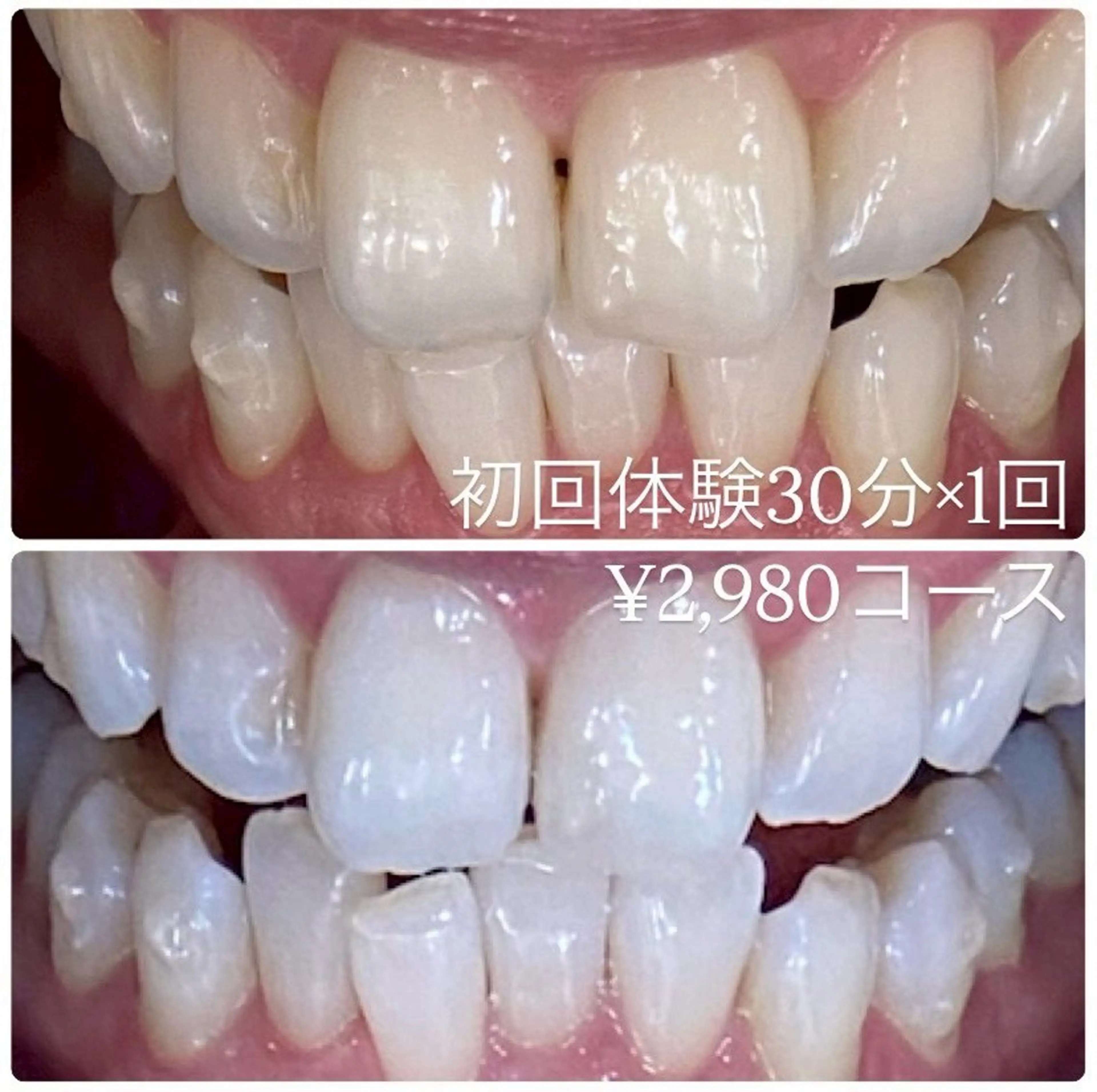 その他 PLATINUM Beauty 横浜店所属・ホワイトニングルーム 横浜店のその他イメージ