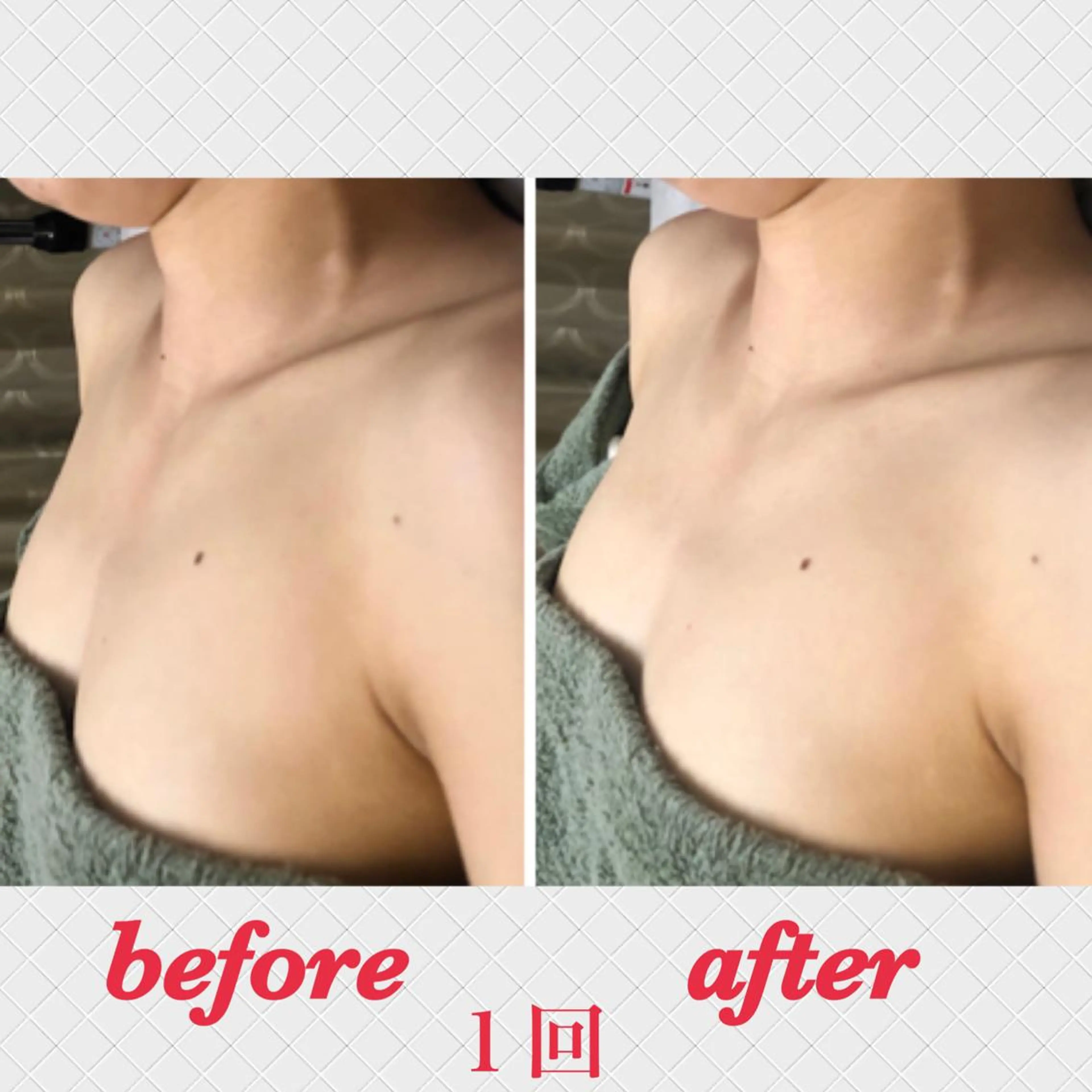 エステ リラク 美ola ビオラのエステ・リラクイメージ