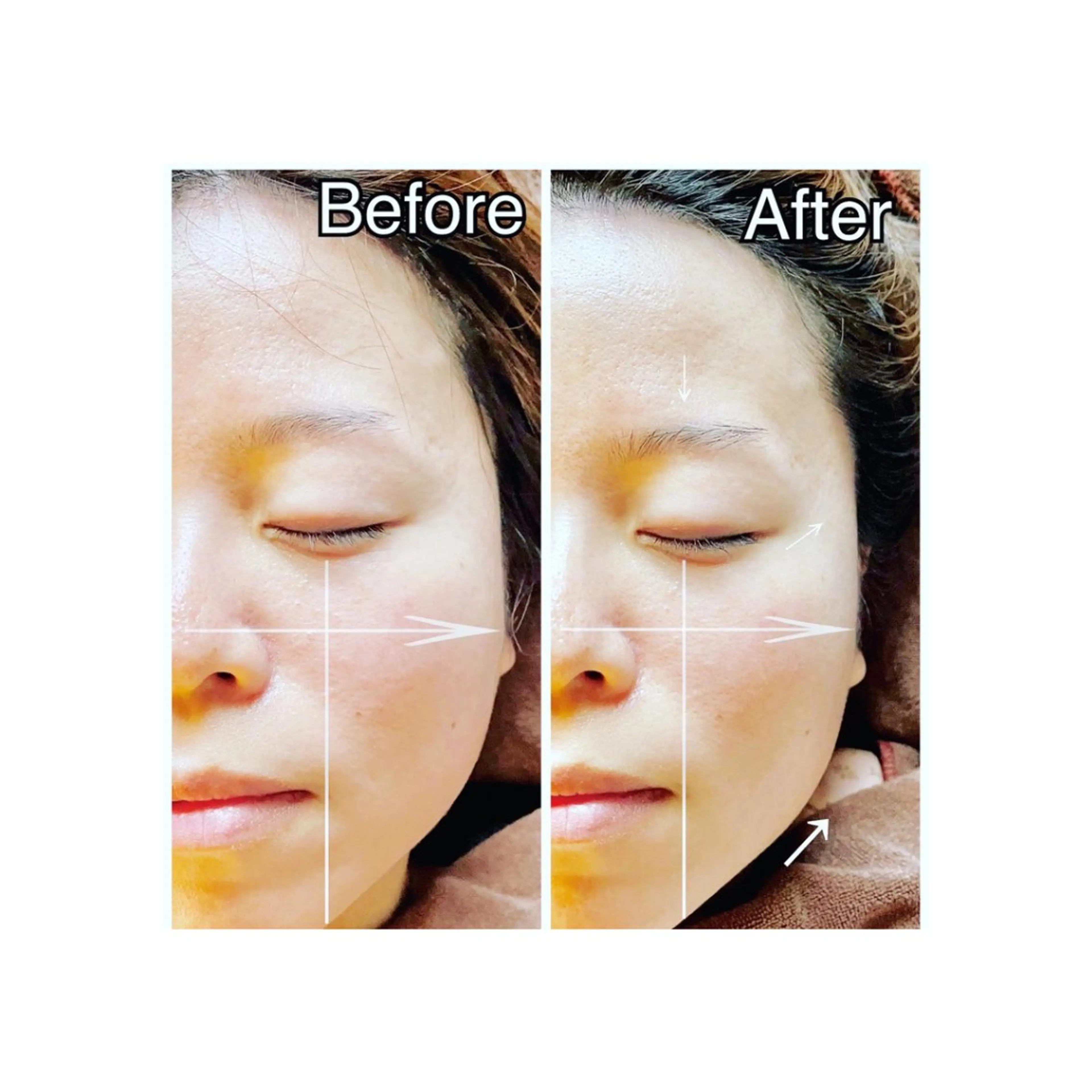 【ミニモ限定】頭蓋骨・小顔矯正初回40分の写真