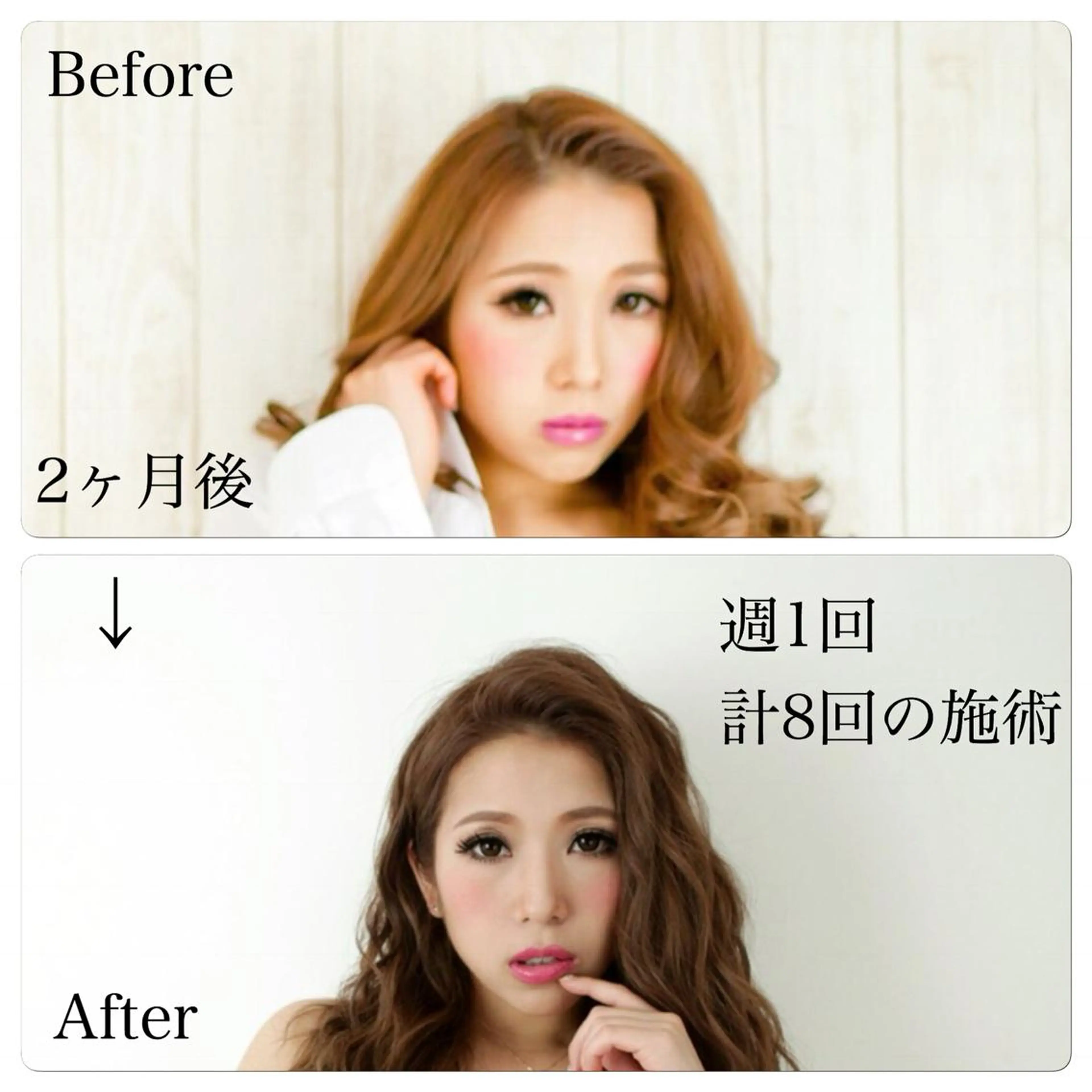 美容鍼 IKEZAKIのエステ・リラクイメージ