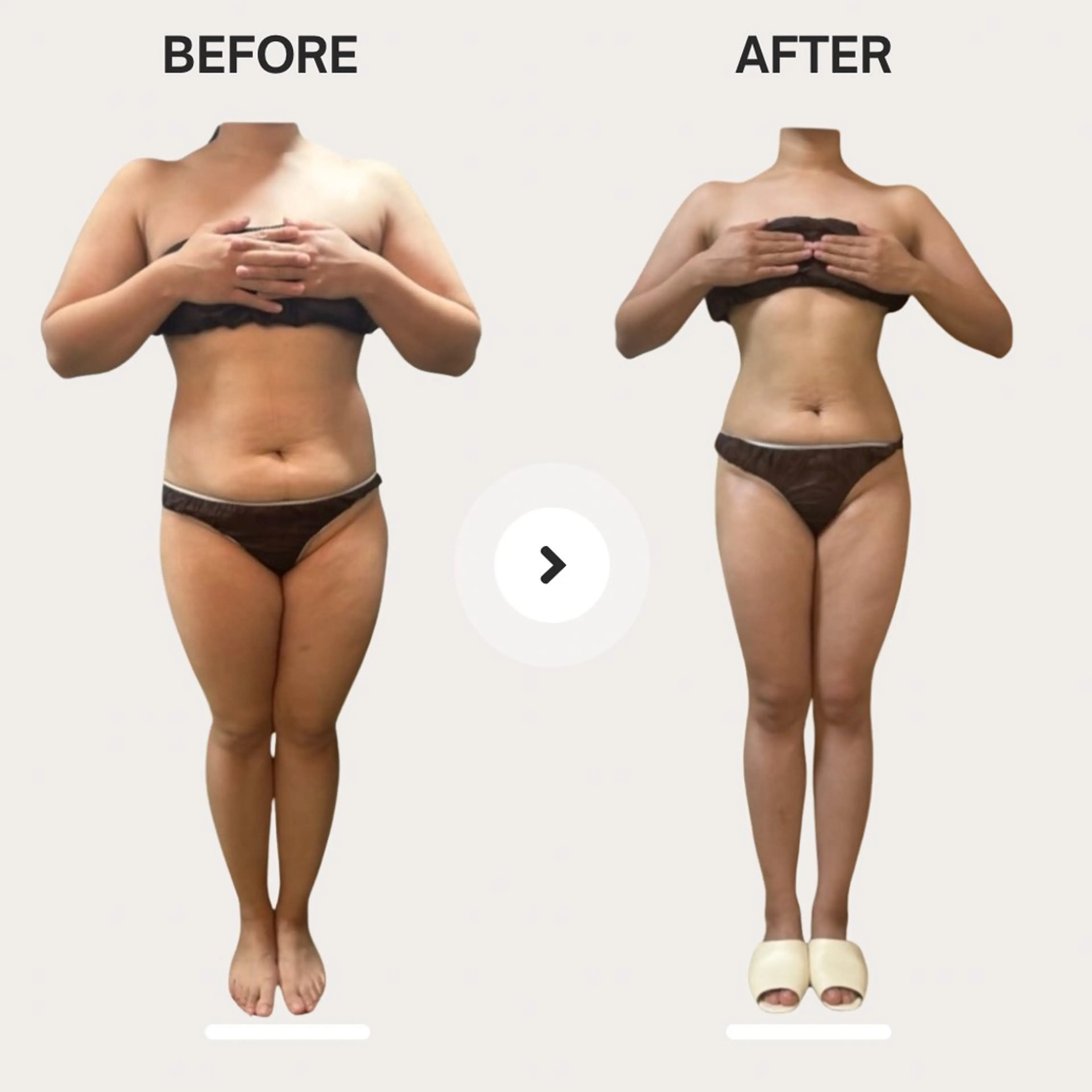 エステ リラク biloop所属・《痩身×疲労改善》 BILOOPのエステ・リラクイメージ