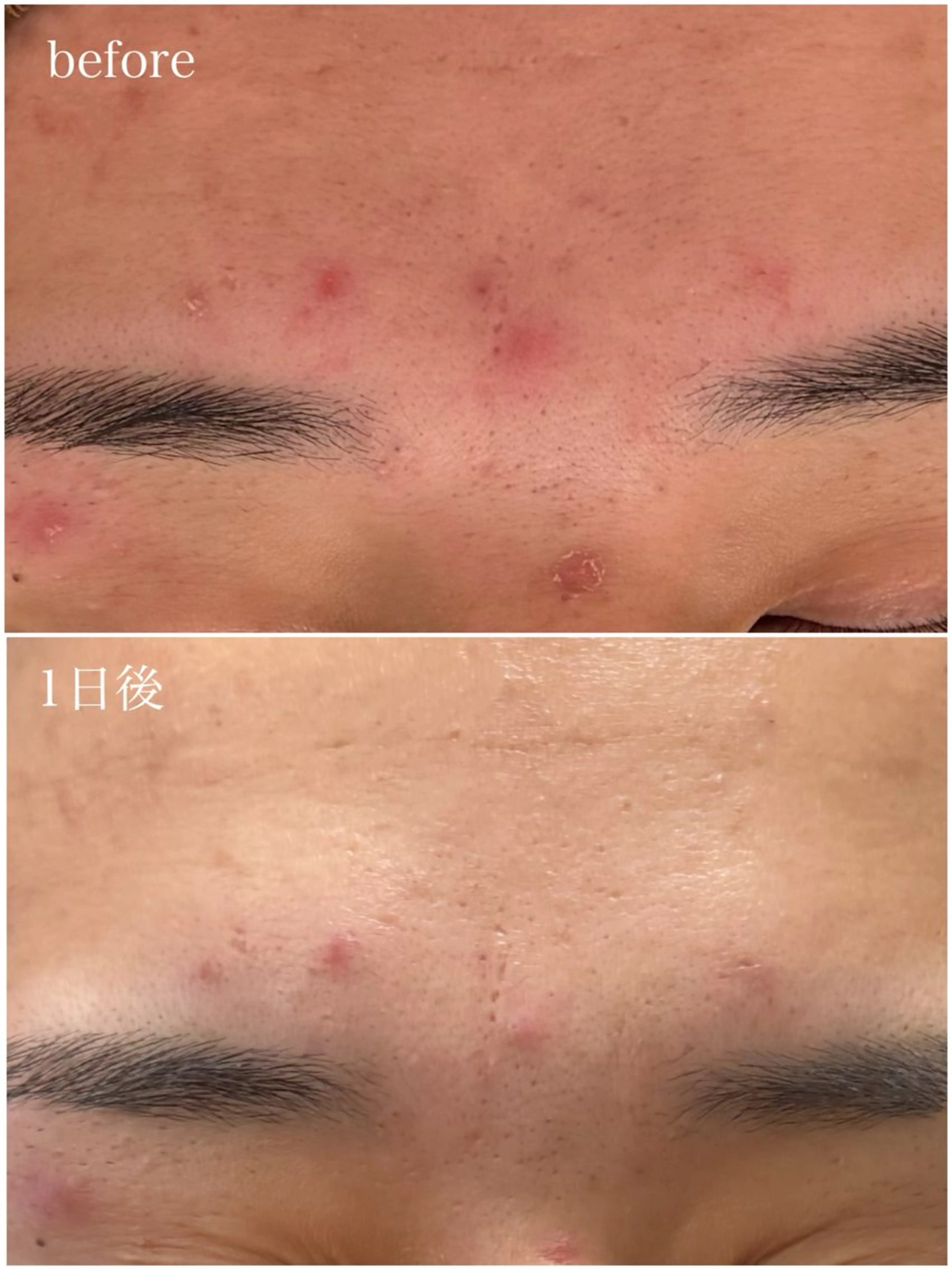 エステ 23beauty所属・武藤 那月のエステ・リラクイメージ