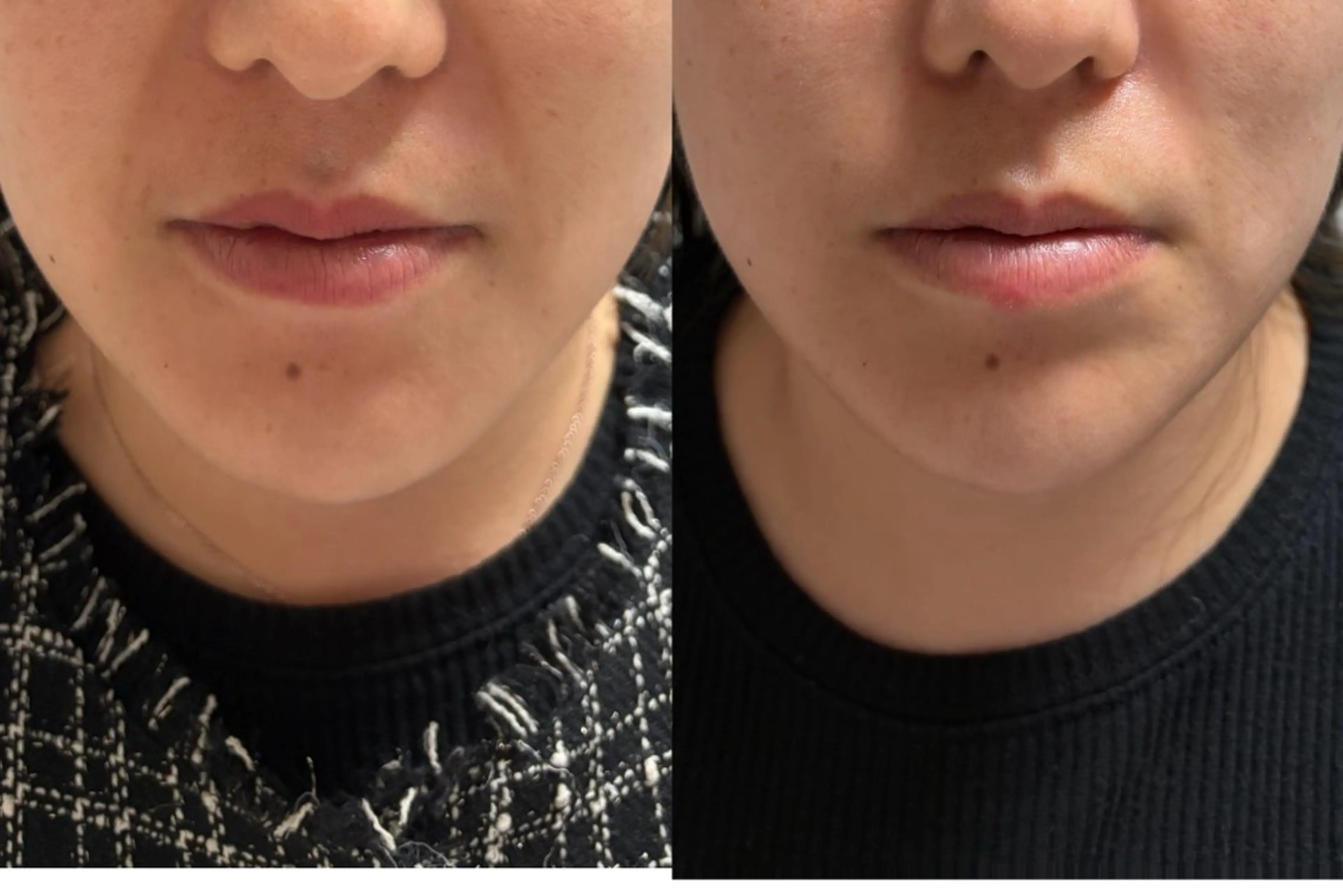 エステ れむりあ 田原のヘアスタイル