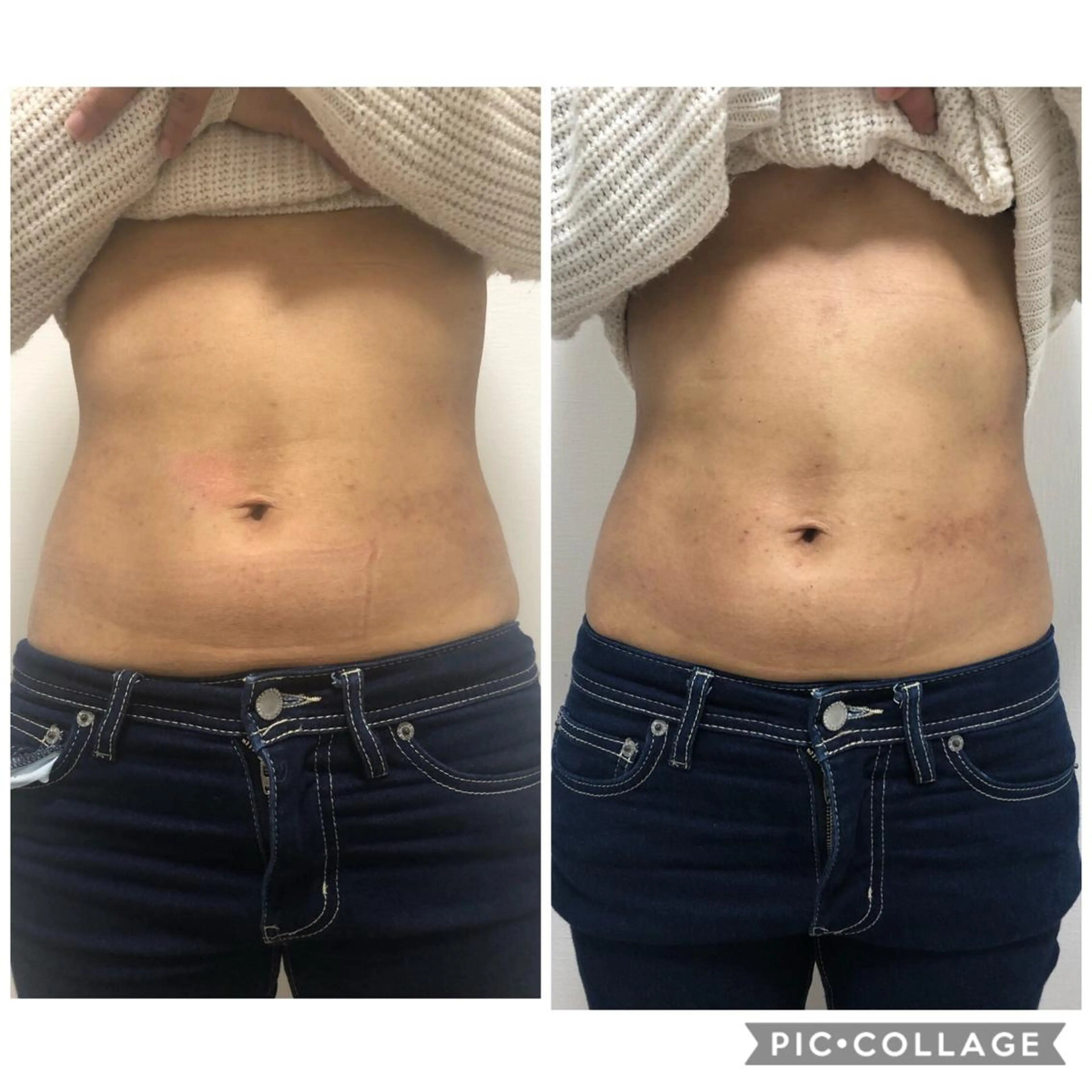 ESPOIR エスポワールのエステ・リラクイメージ