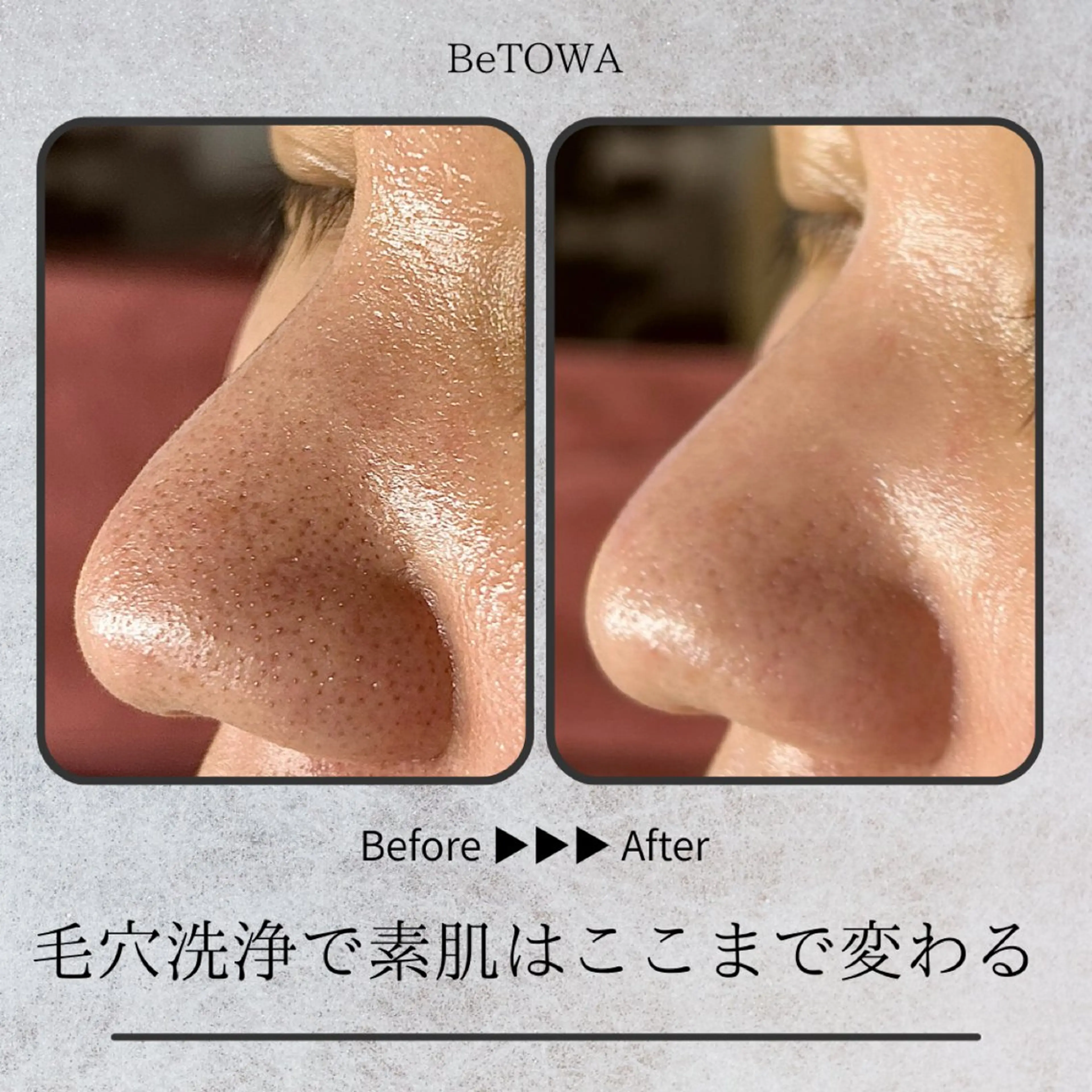 エステ BeTOWA所属・BeTOWA 毛穴洗浄／Wax脱毛のエステ・リラクイメージ