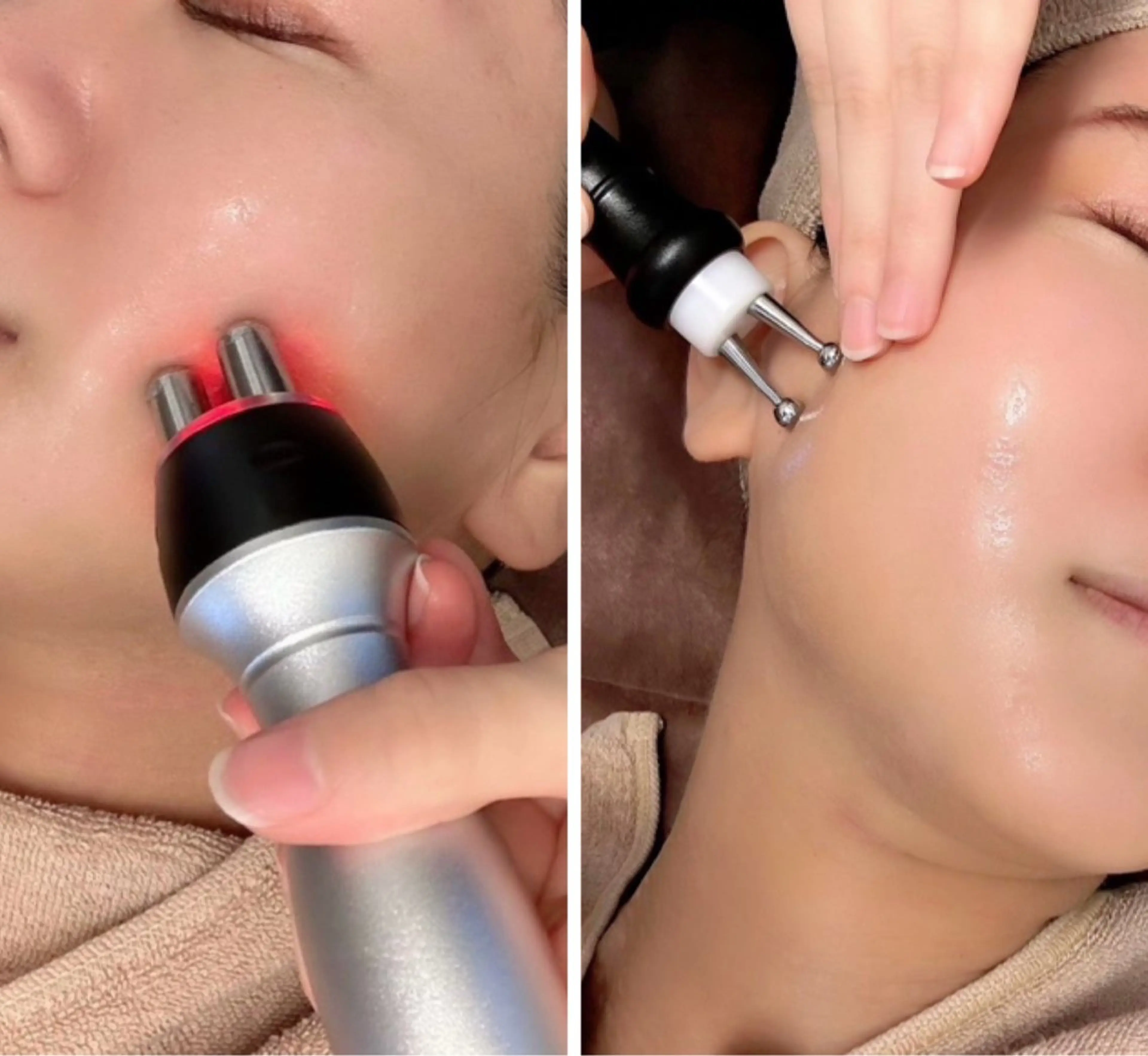 minimo特別🌈ラジオ波＋EMS＋エニシーグローパック💎(炭酸ガスパック)首肩デコルテ+ドライヘッド 80分の写真