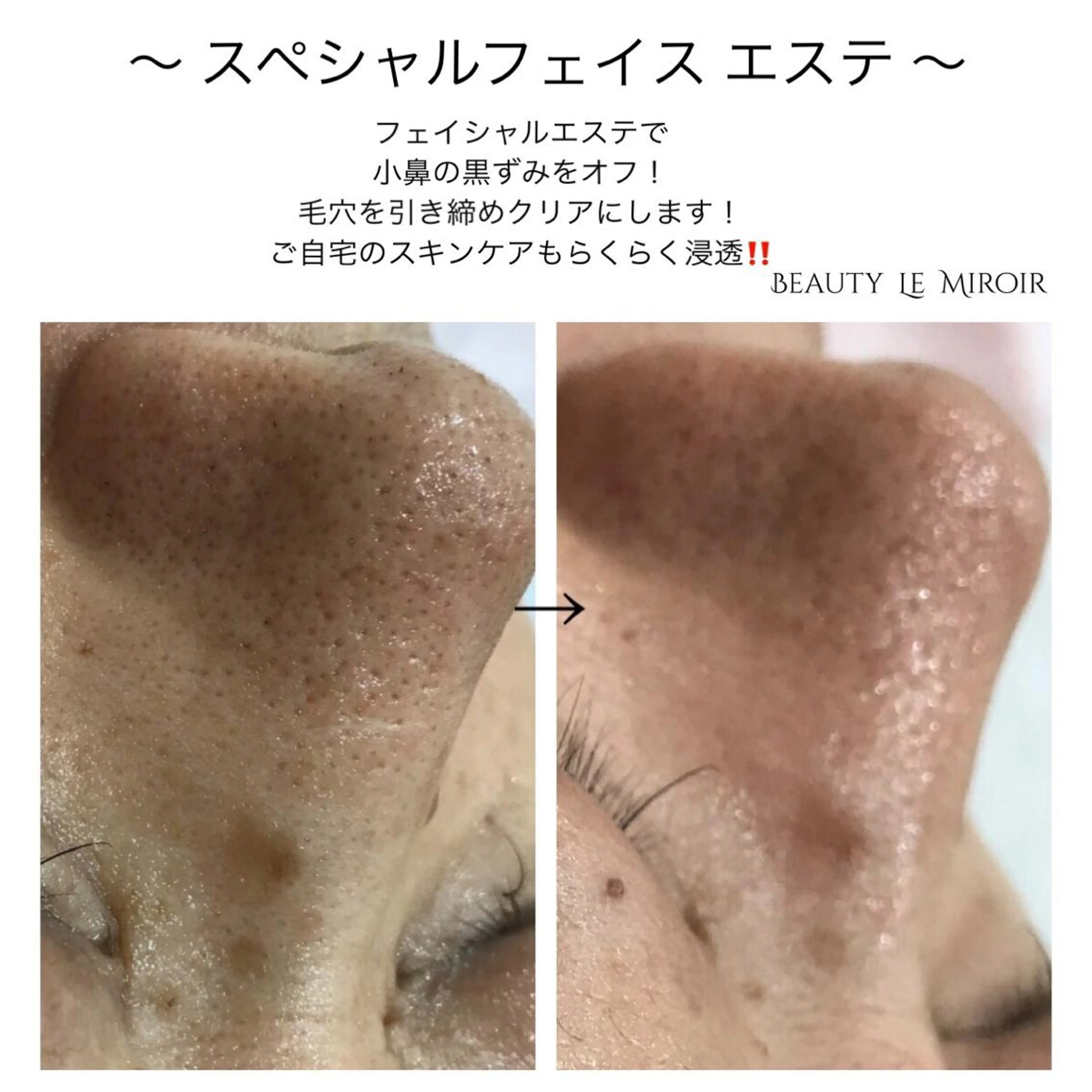 ビューティー ミロワールのエステ・リラクイメージ