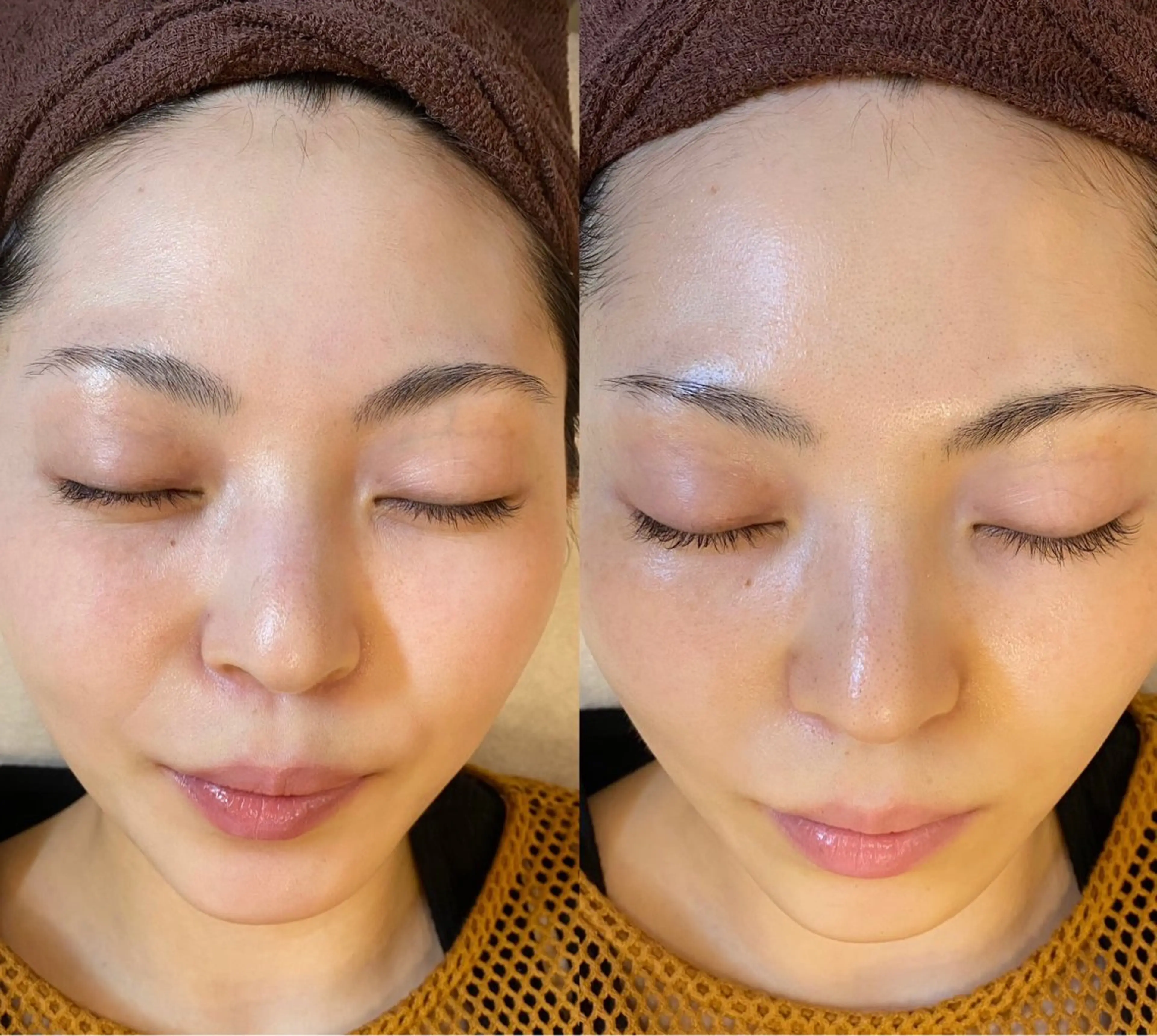 ハーブピーリング🌿 脱毛🧡ヘッドスパのエステ・リラクイメージ