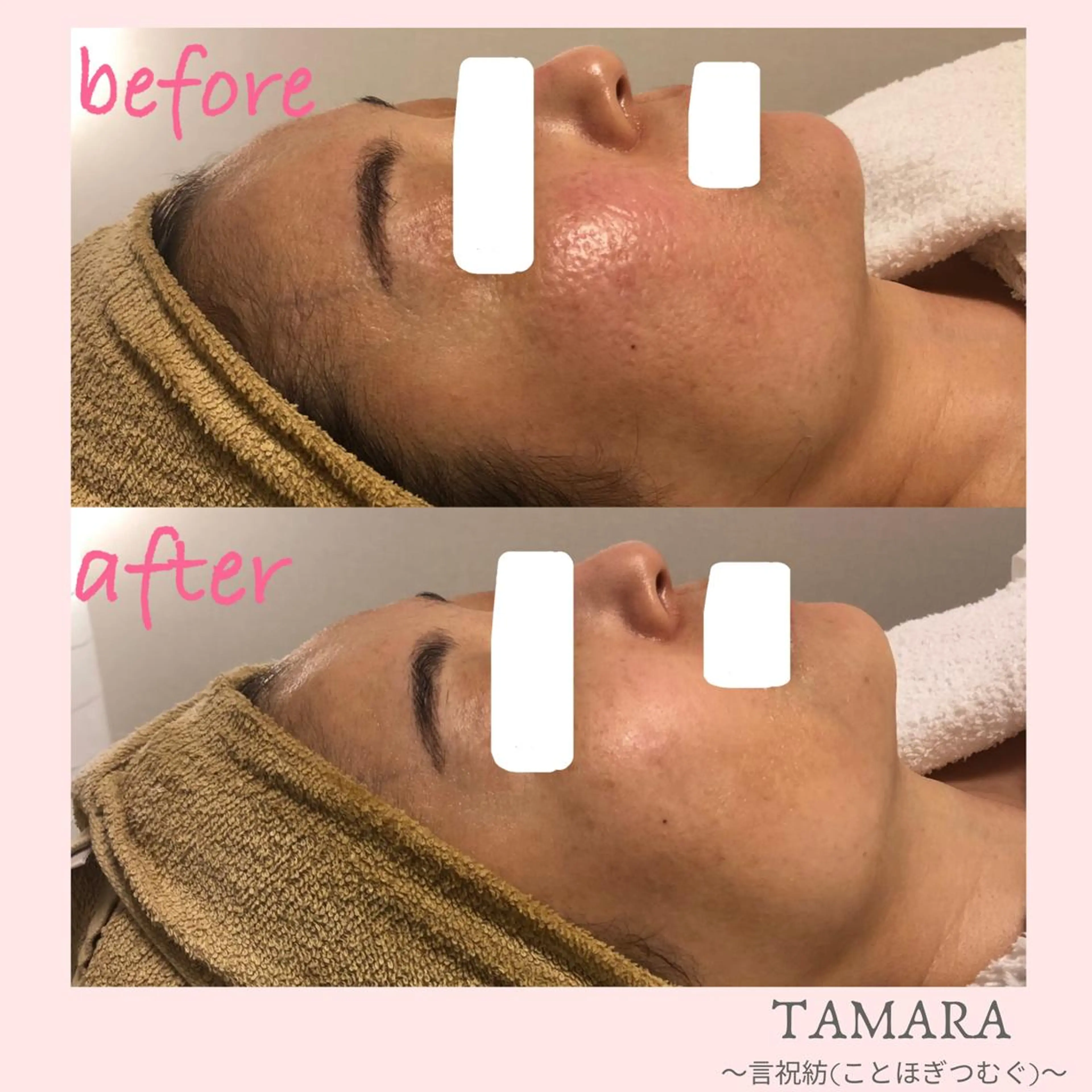 エステ リラク TAMARA 松下のエステ・リラクイメージ