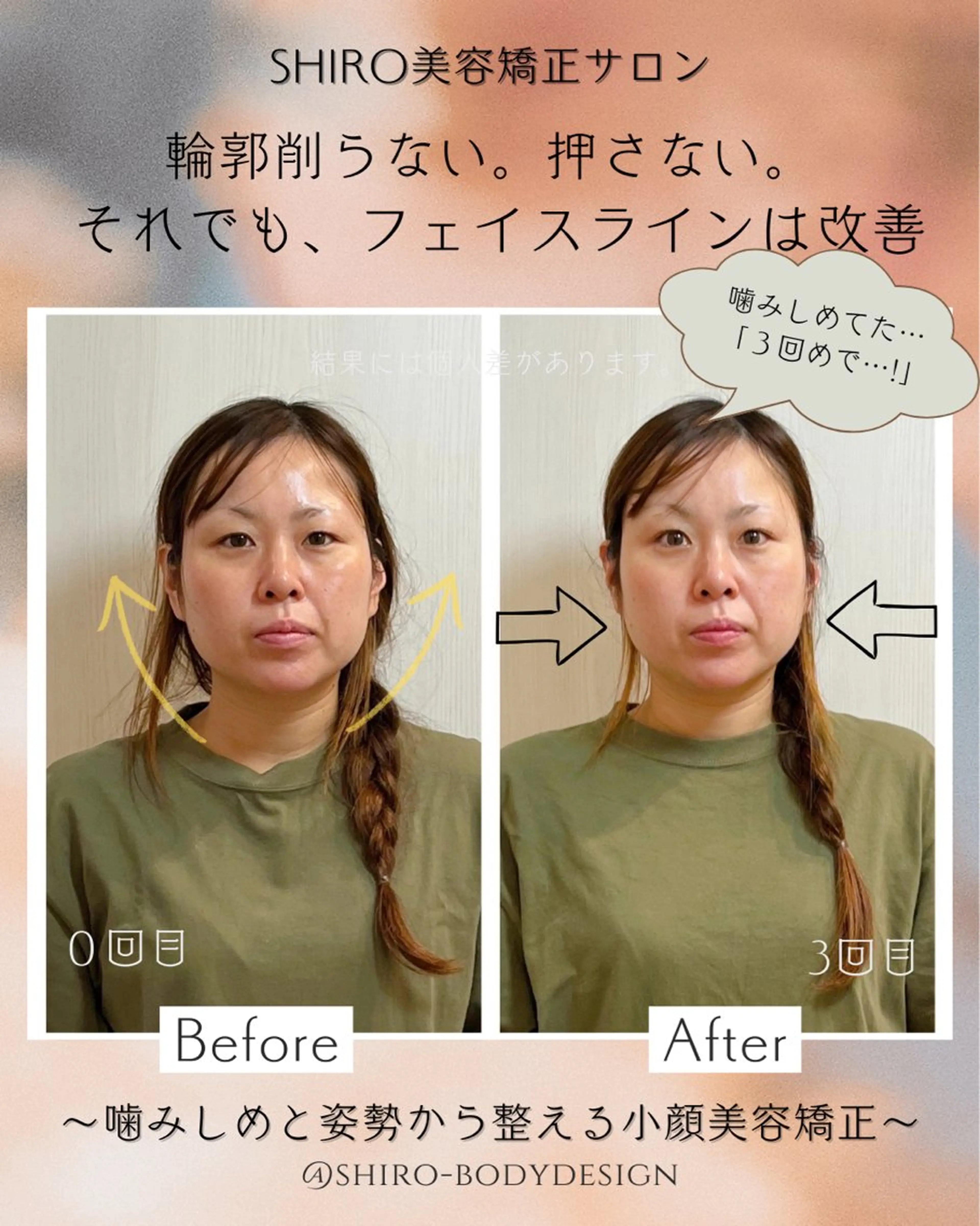 小顔美容矯正勝山式 shiroしろのエステ・リラクイメージ