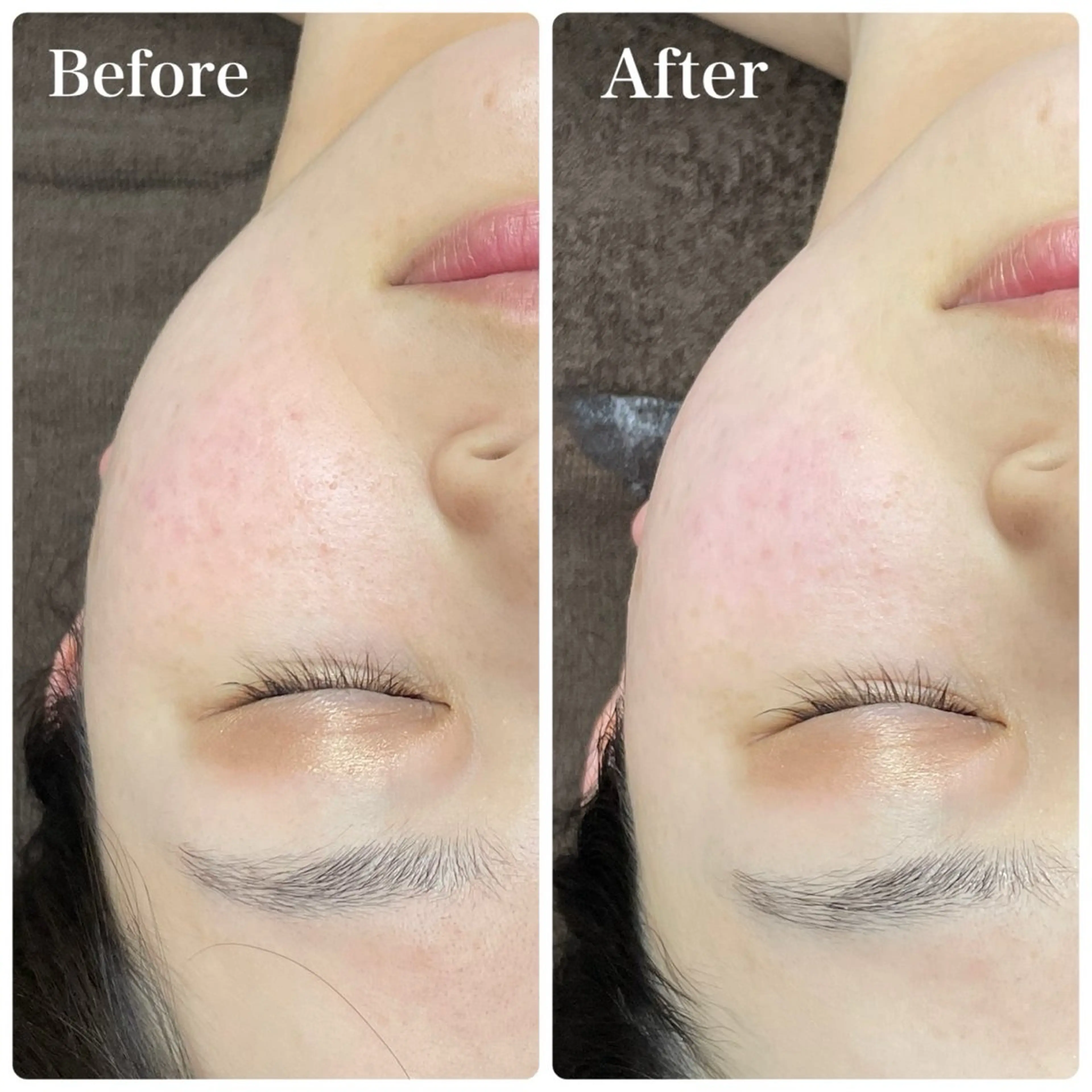 MIRAI小顔 溝の口店のエステ・リラクイメージ