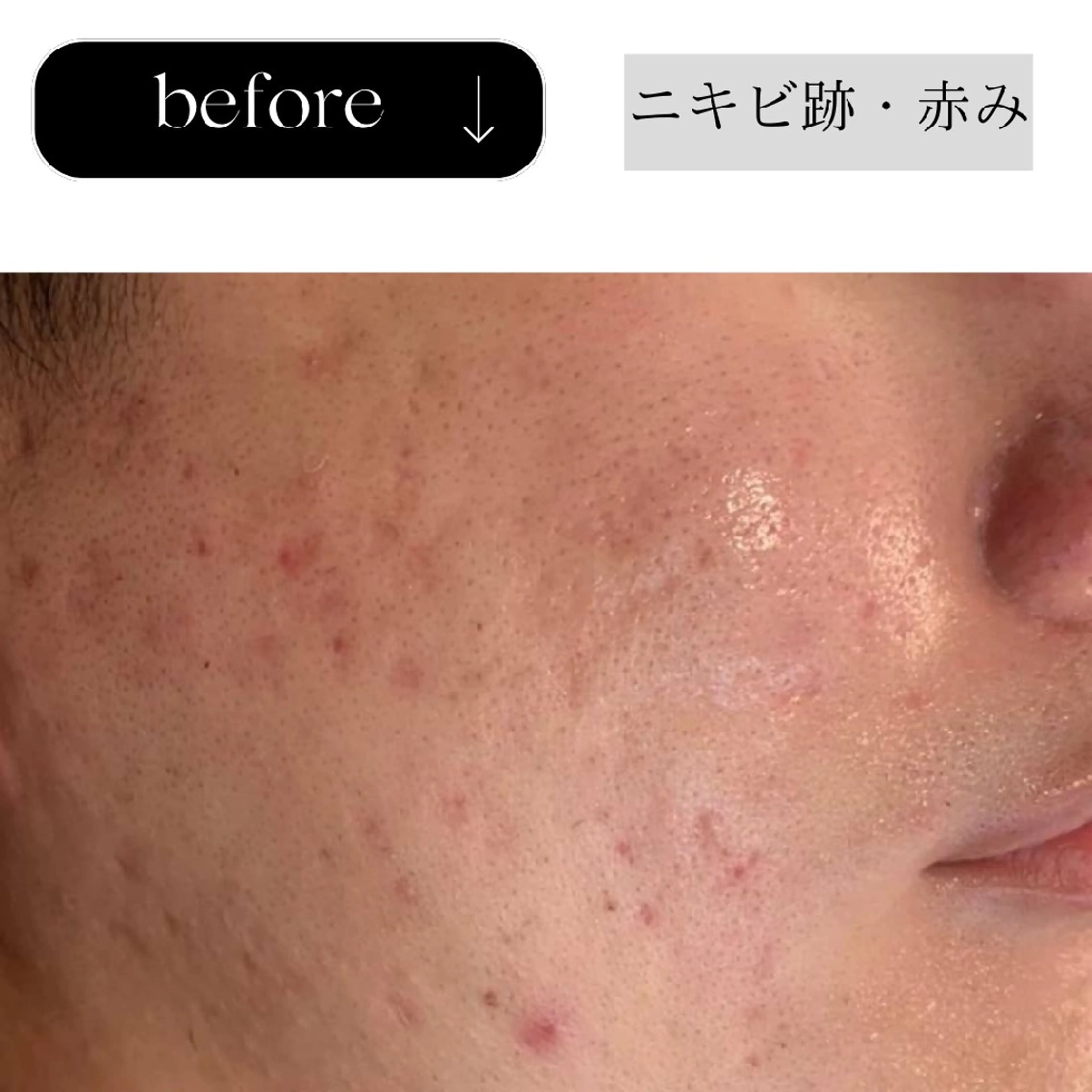 ICHOOSE/ 代々木上原のエステ・リラクイメージ