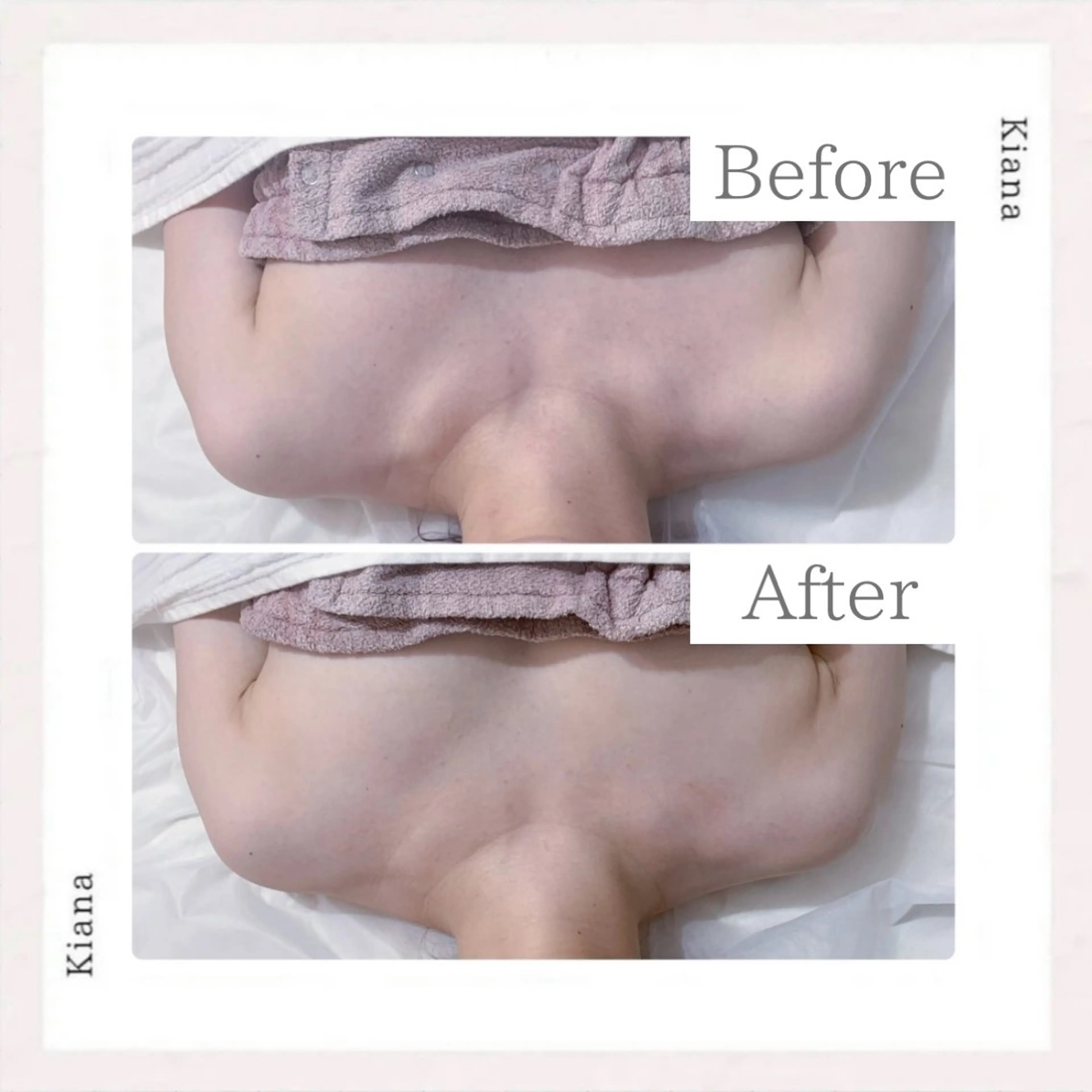 エステ リラク バスト専門Kiana 風のエステ・リラクイメージ