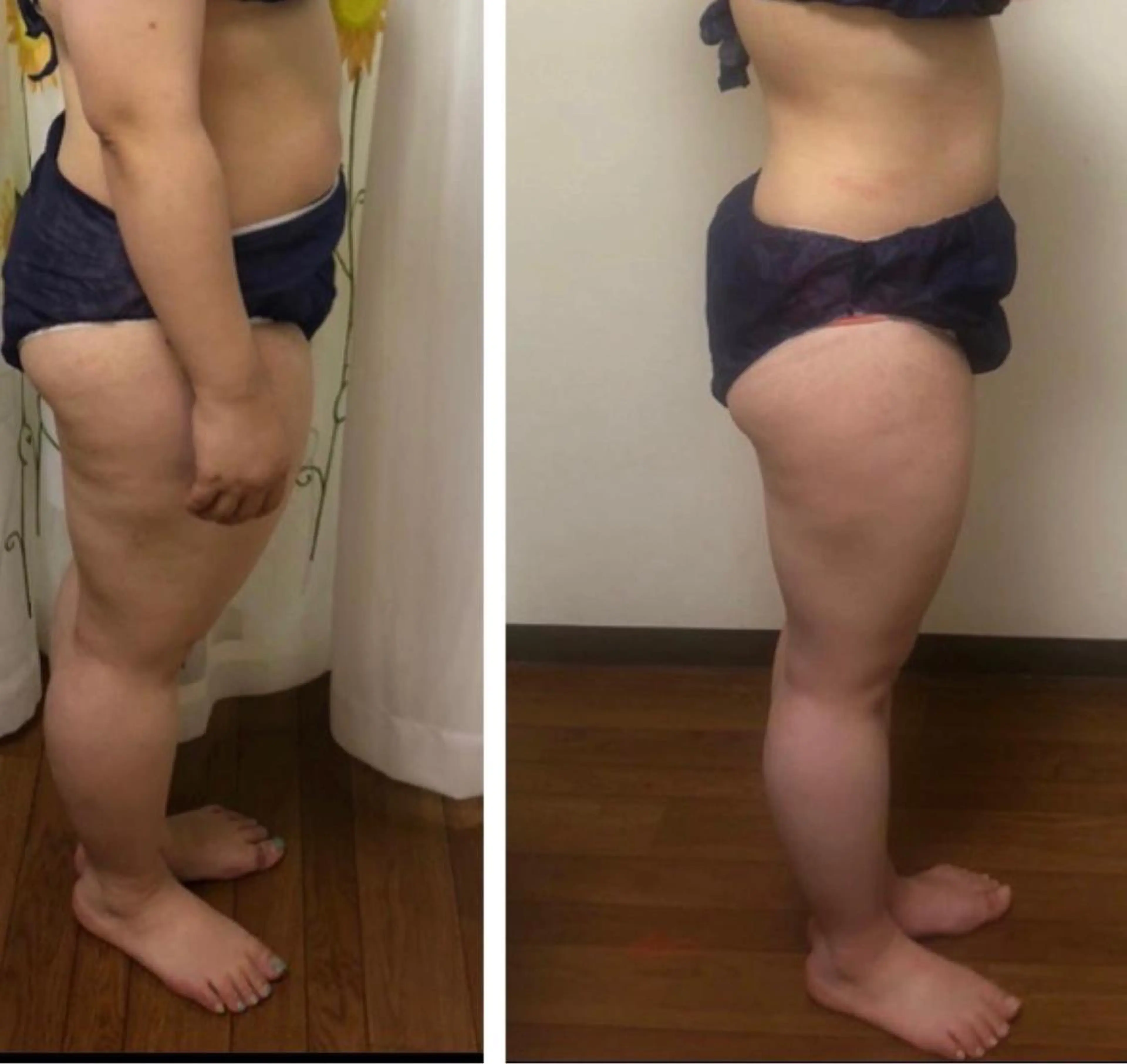 超悶絶サロンひまわり所属・村岸 恵美のエステ・リラクイメージ