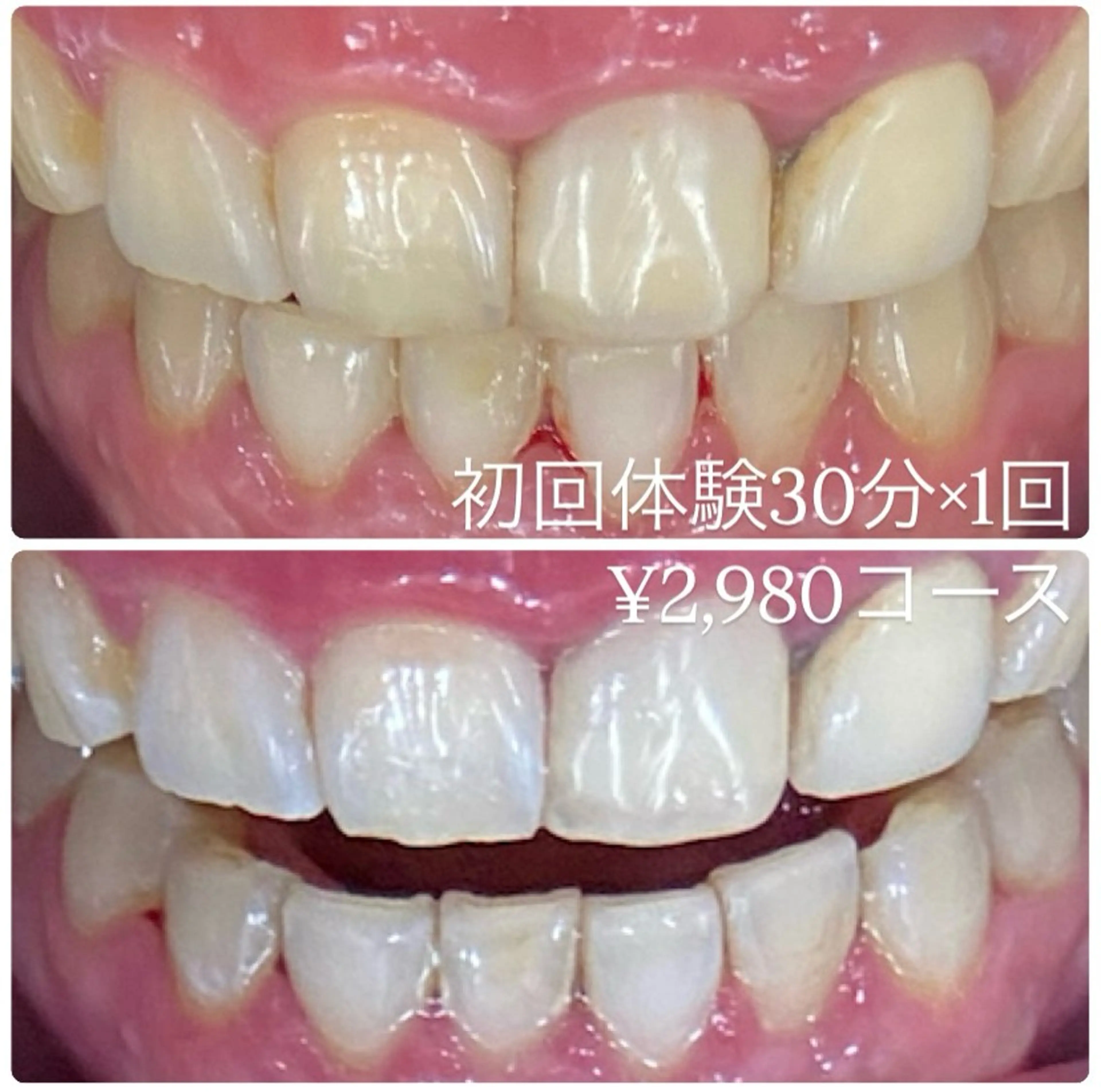 PLATINUM Beauty 横浜店所属・ホワイトニングルーム 横浜店のその他イメージ