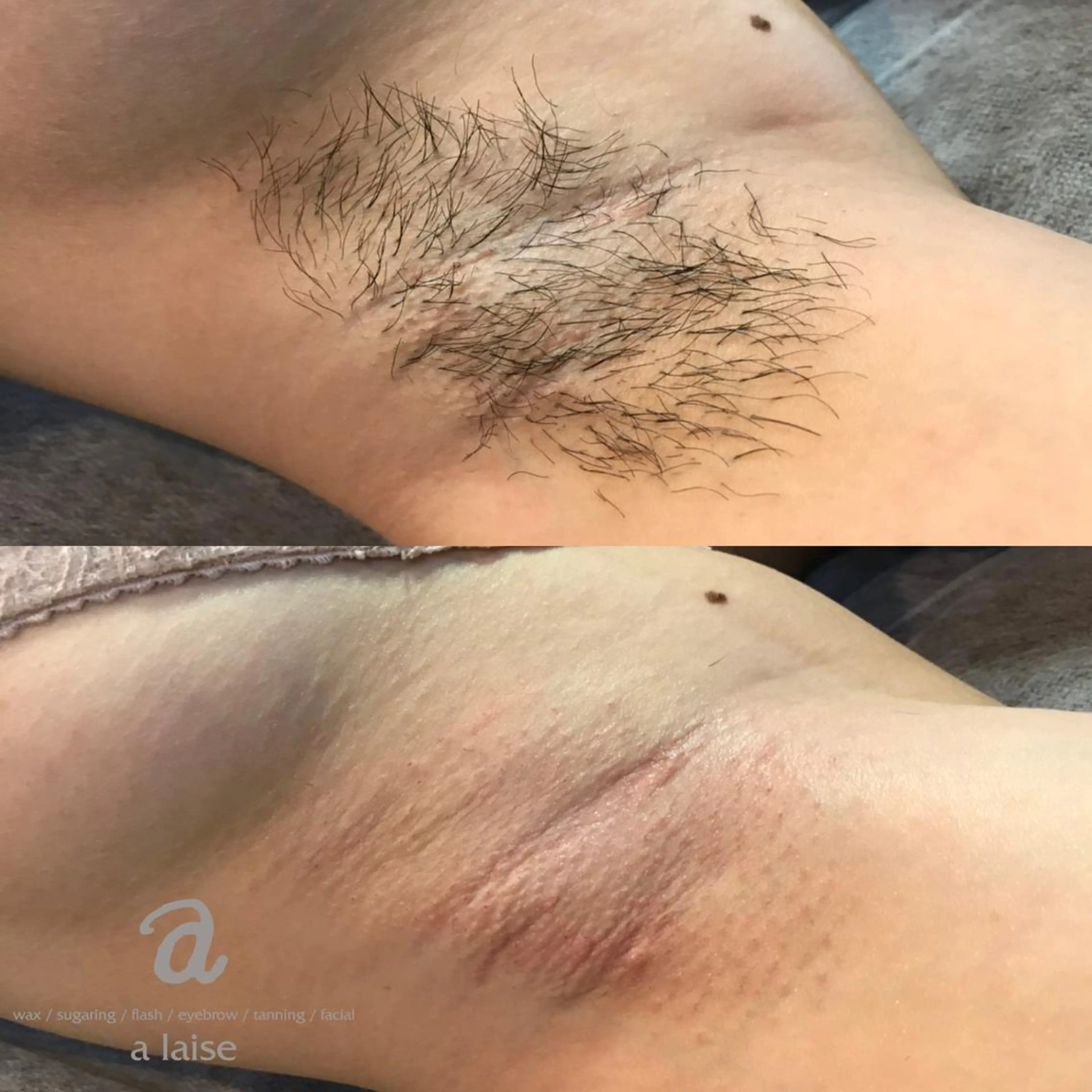 メンズ キッズ a laise 斉藤（表参道）のエステ・リラクイメージ