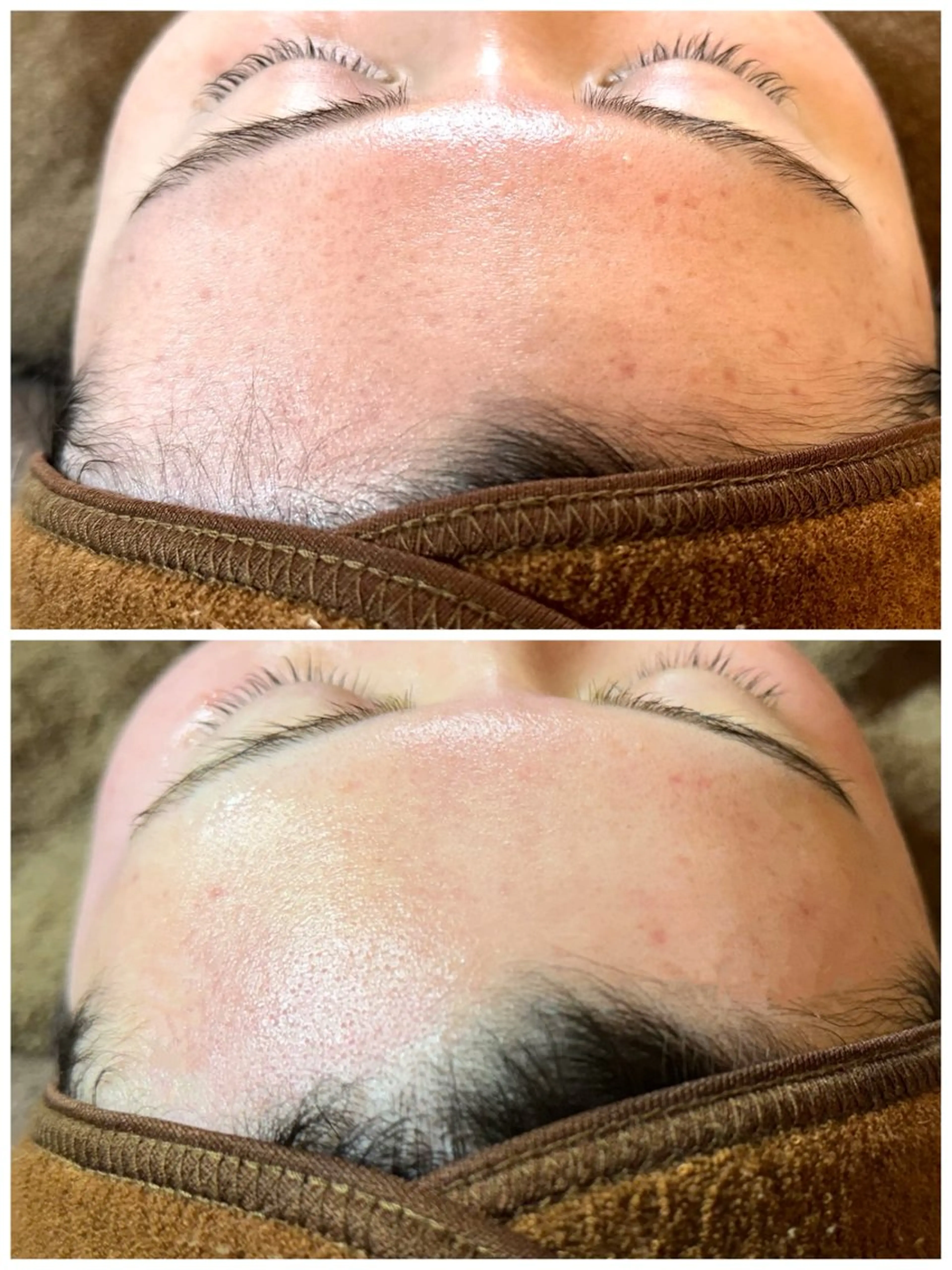 《メンズ限定👊🏻🩵》モニター価格🌟フェイシャルワックス脱毛🌿～クレンジング,洗顔,保湿,Wax,高保湿パック～の写真