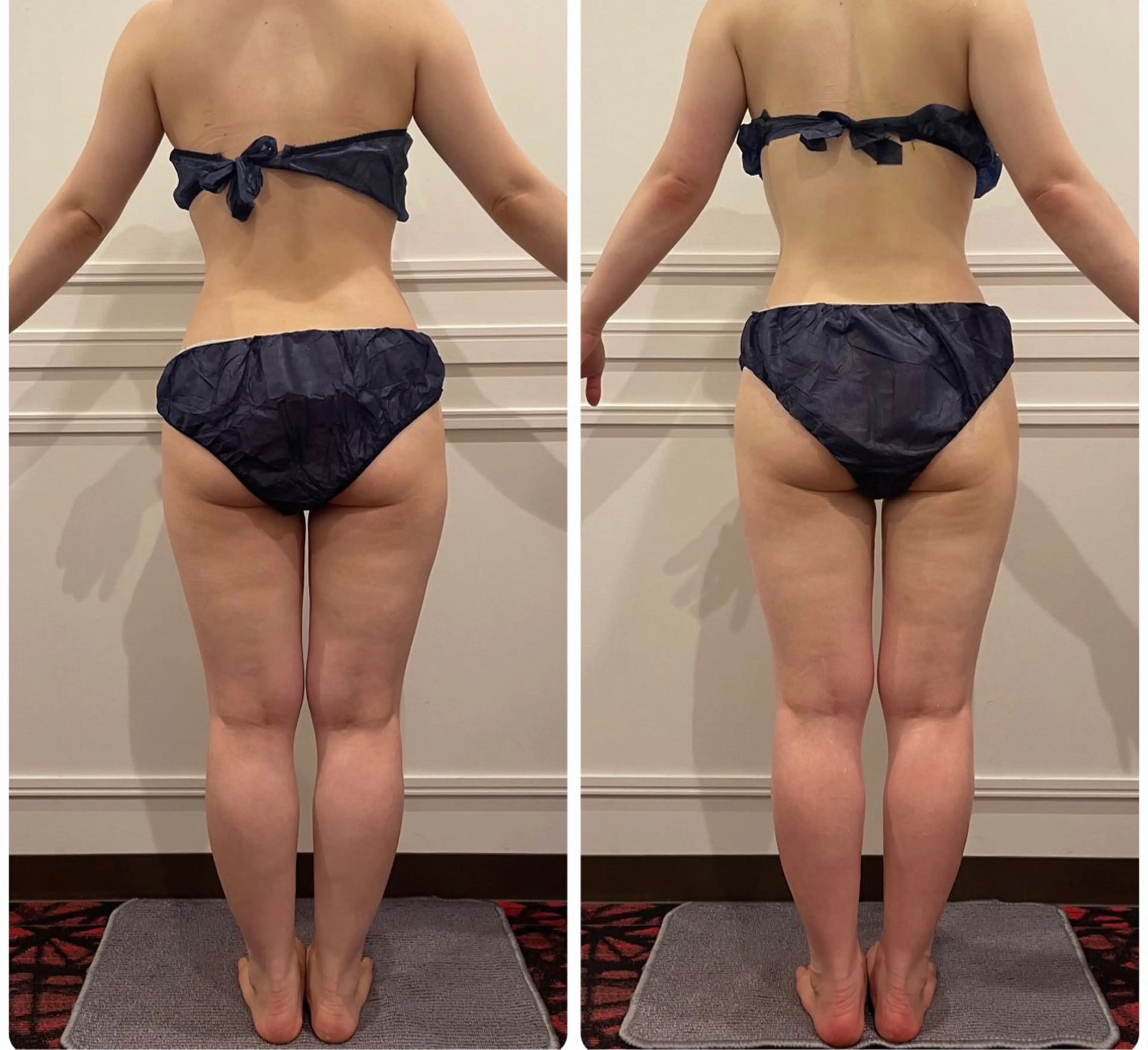 立体小顔×艶肌×美ボ ディ似合わせ施術 岡のエステ・リラクイメージ