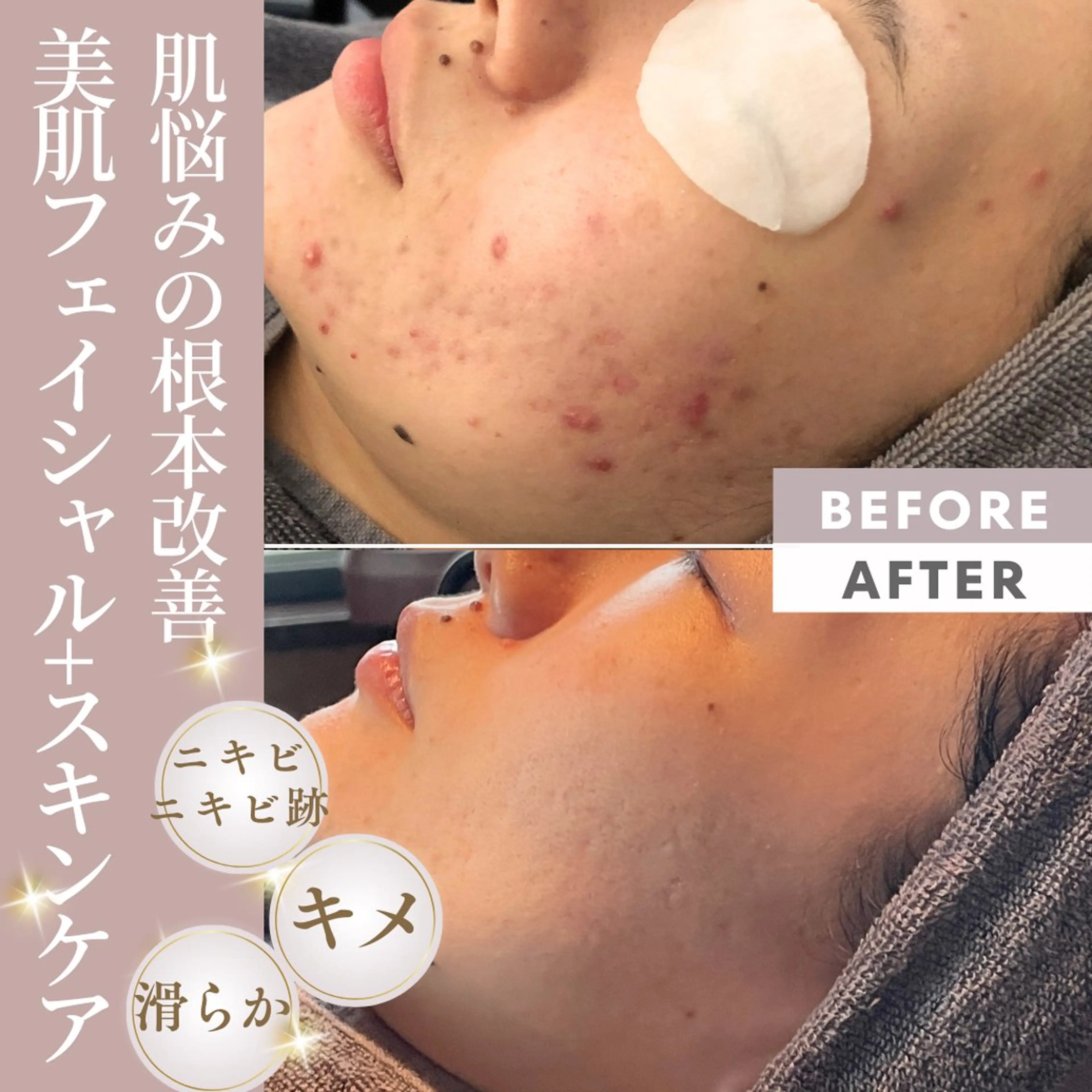 Beauty salon  Liko所属・LIKO フェイシャル&ボディのエステ・リラクイメージ