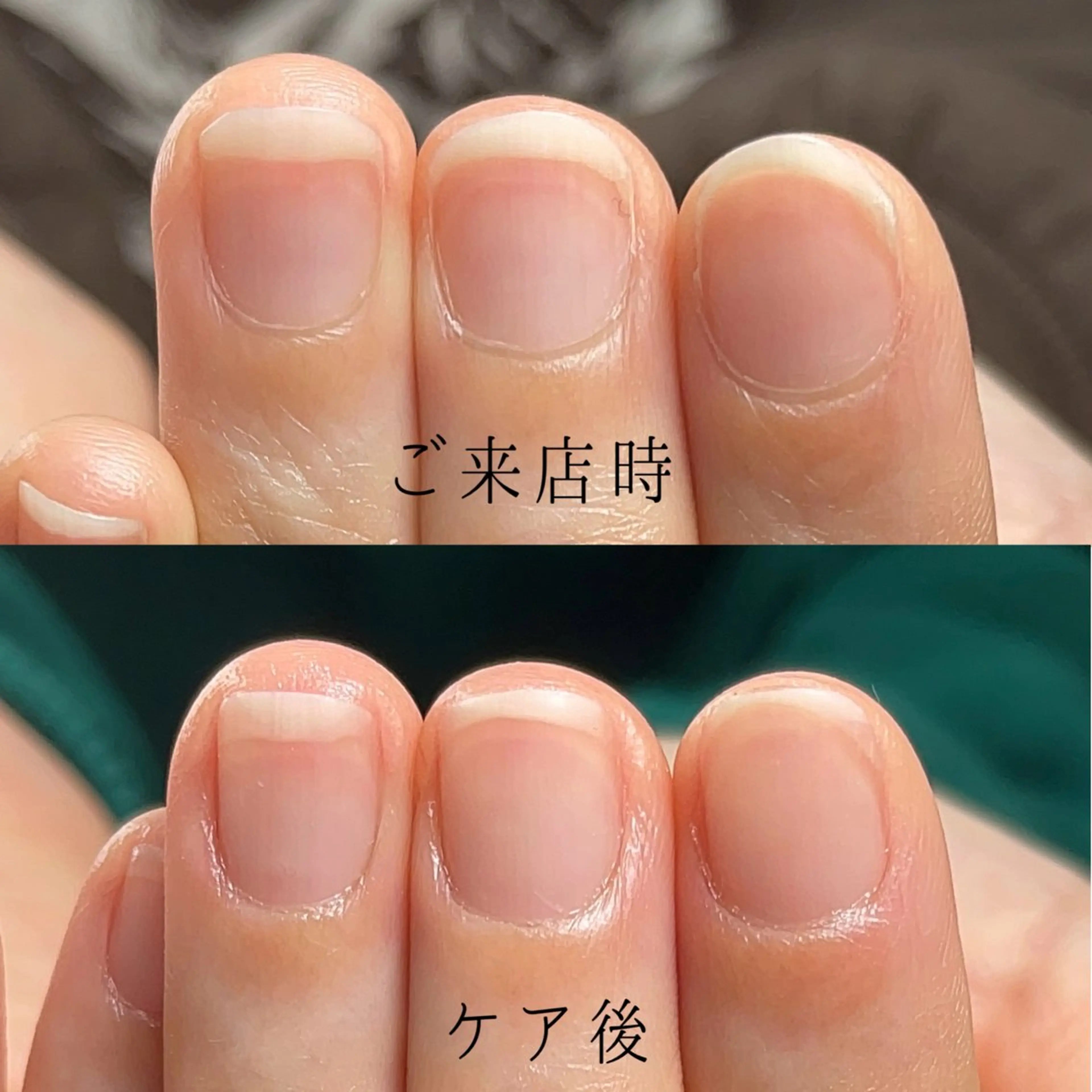 ネイル ジェルネイル Aim* 深爪・自爪育成専門店のネイルデザイン